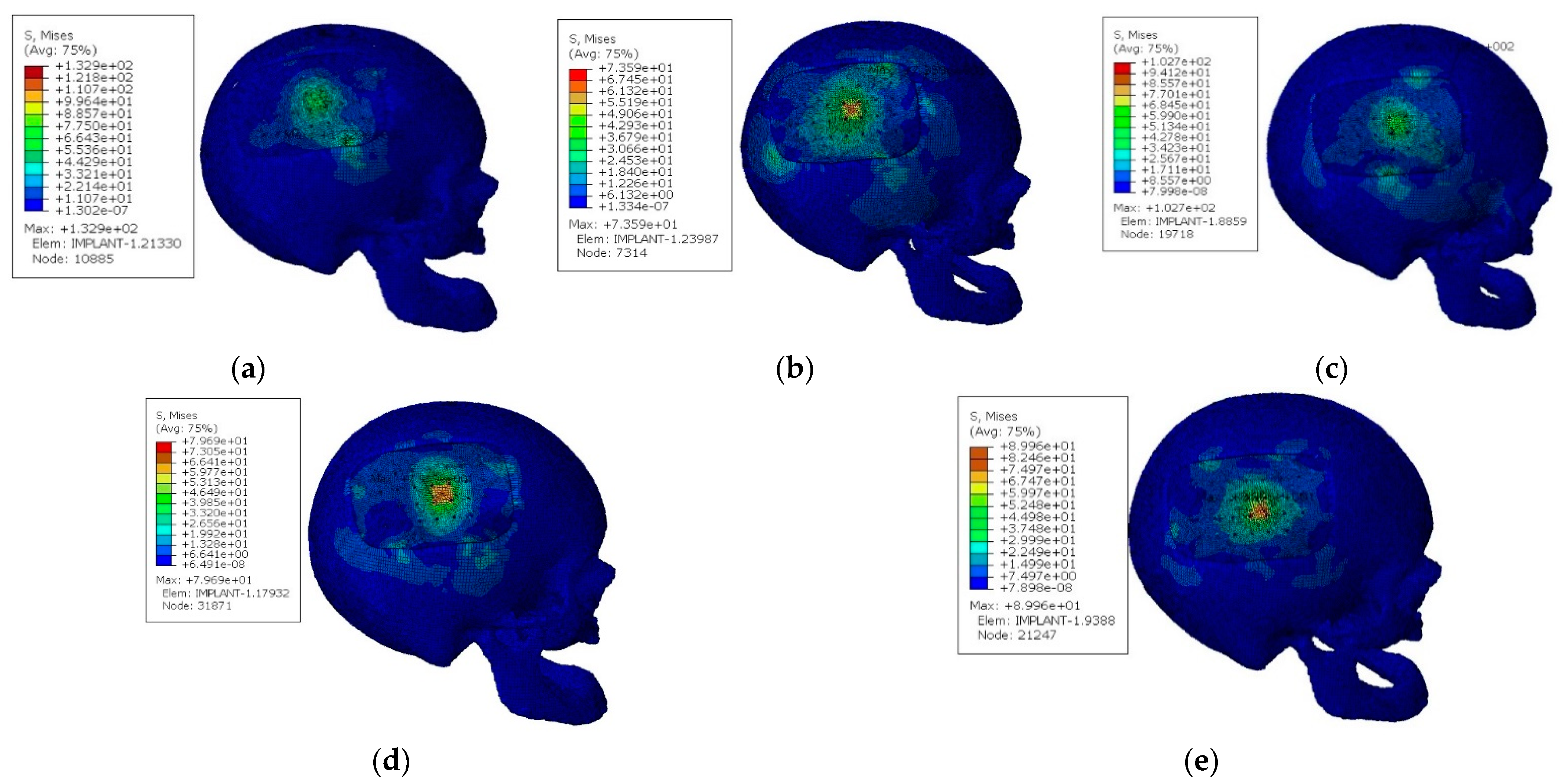 Applsci 12 00878 g004