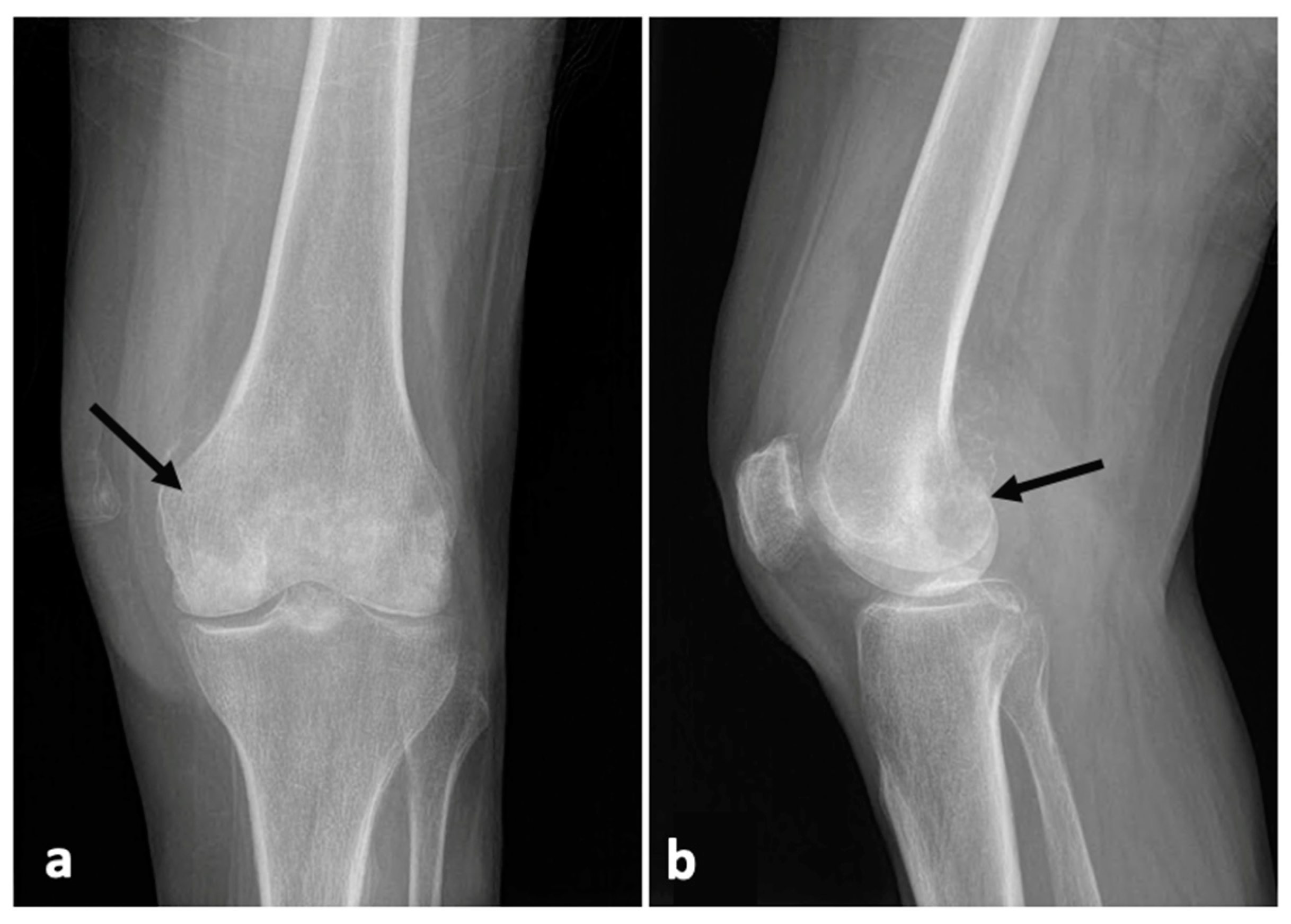 Medical Library Knee 75