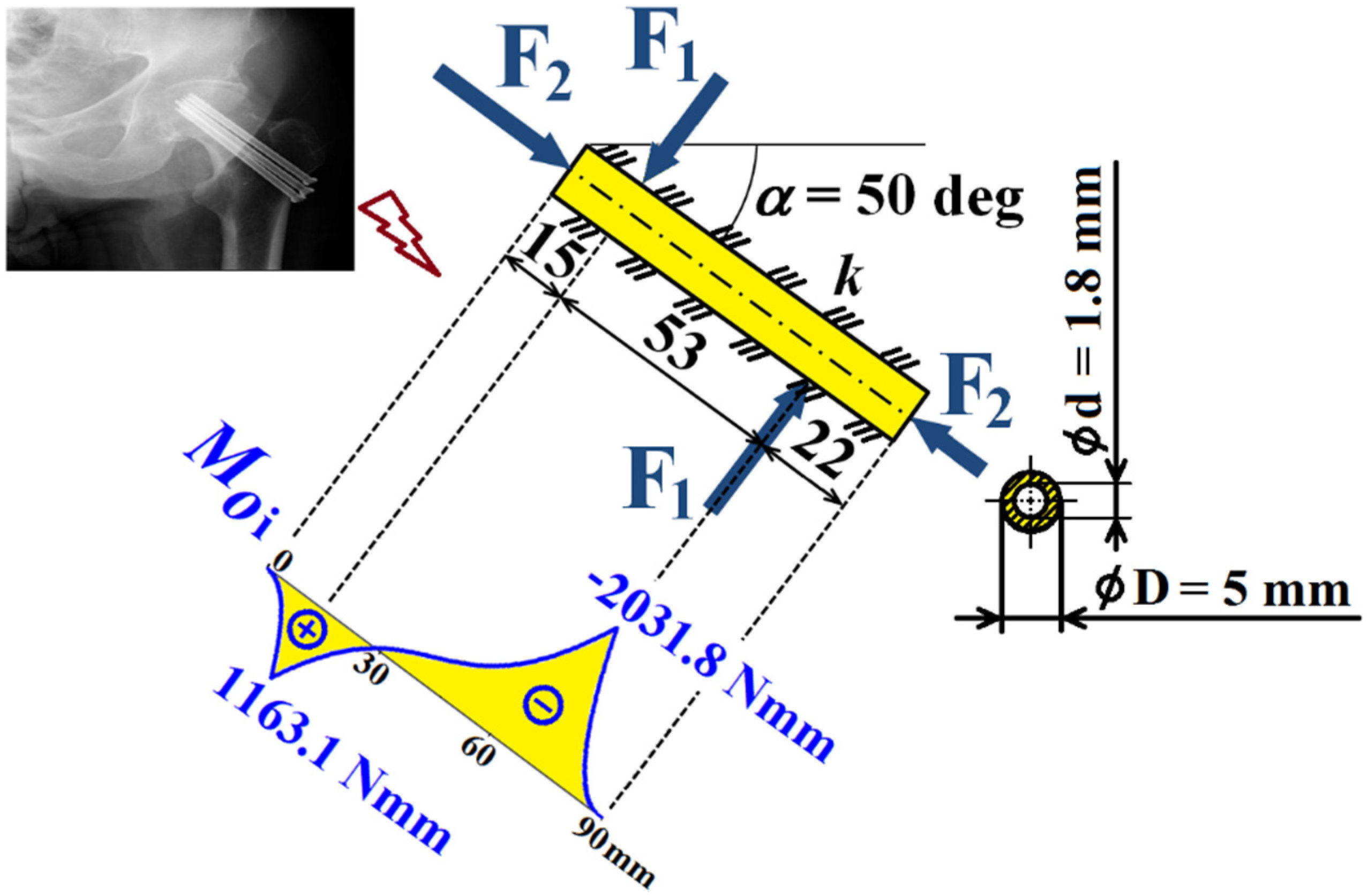 Applsci 12 01015 g009 Applsci 12 01015 g009