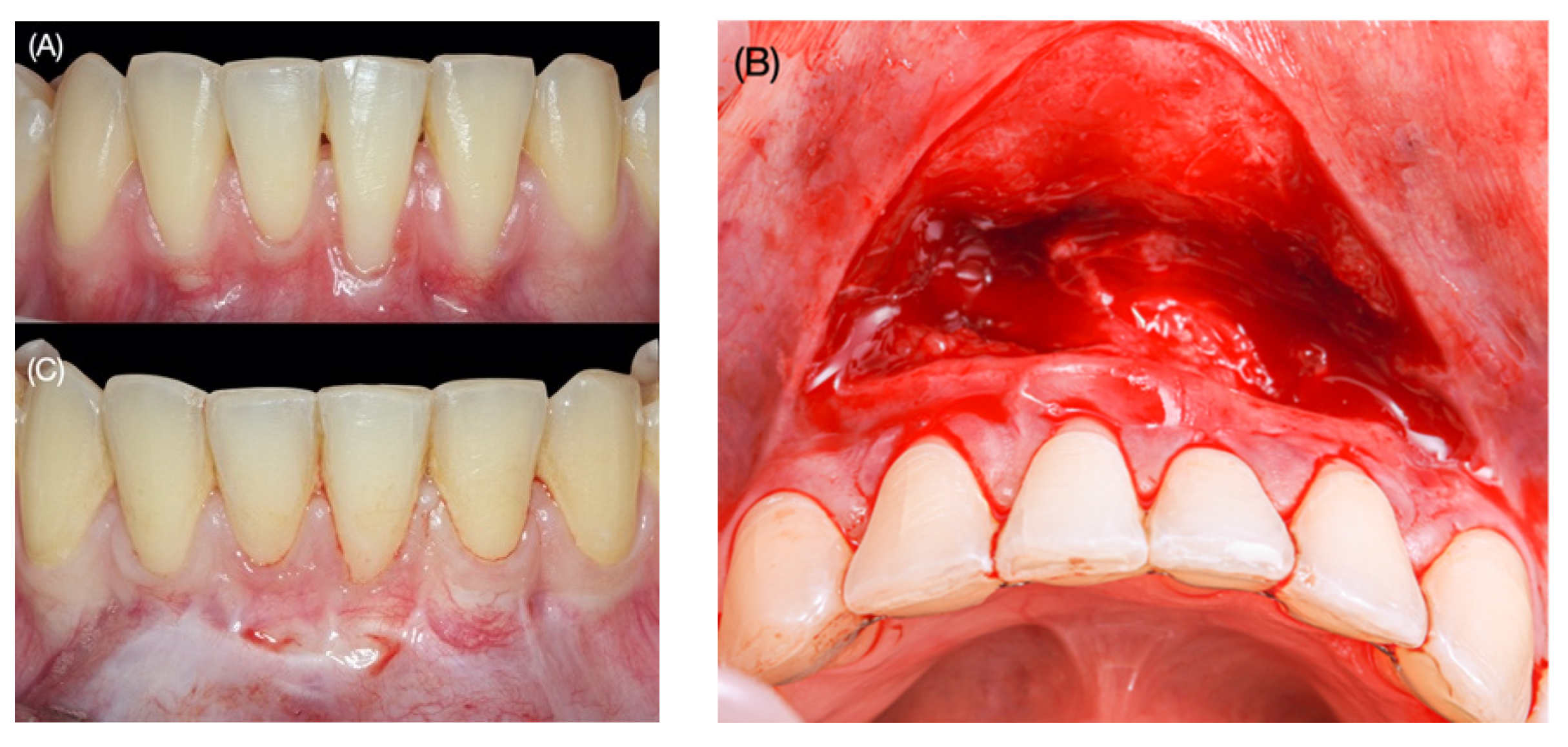 Applsci 12 01038 g002 Applsci 12 01038 g002