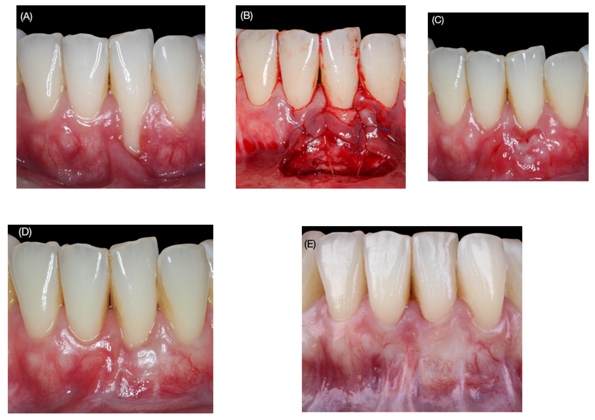 Applsci 12 01038 g003 Applsci 12 01038 g003