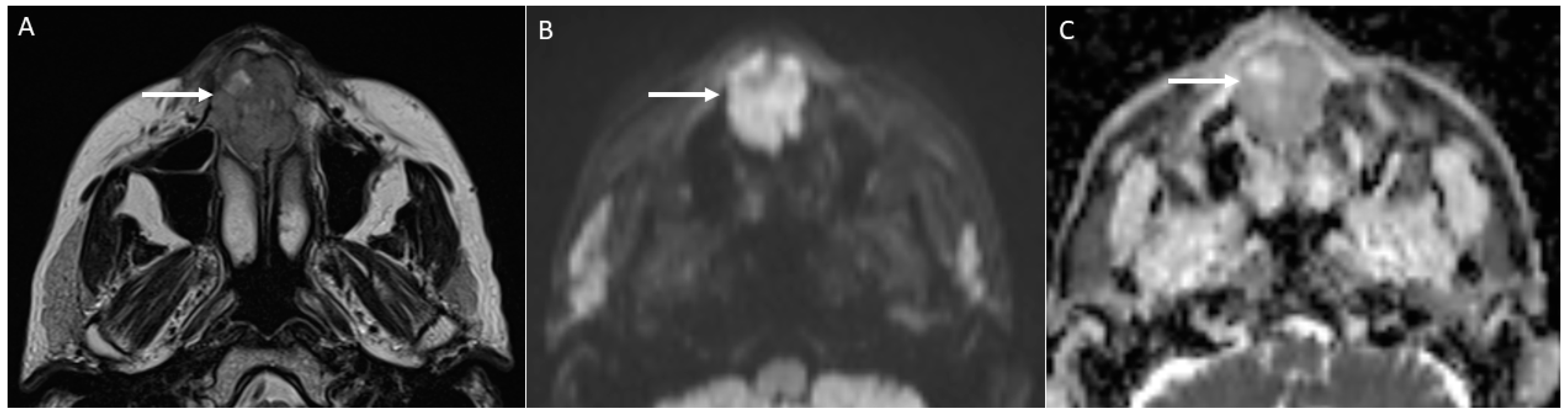 Applsci 12 01473 g005