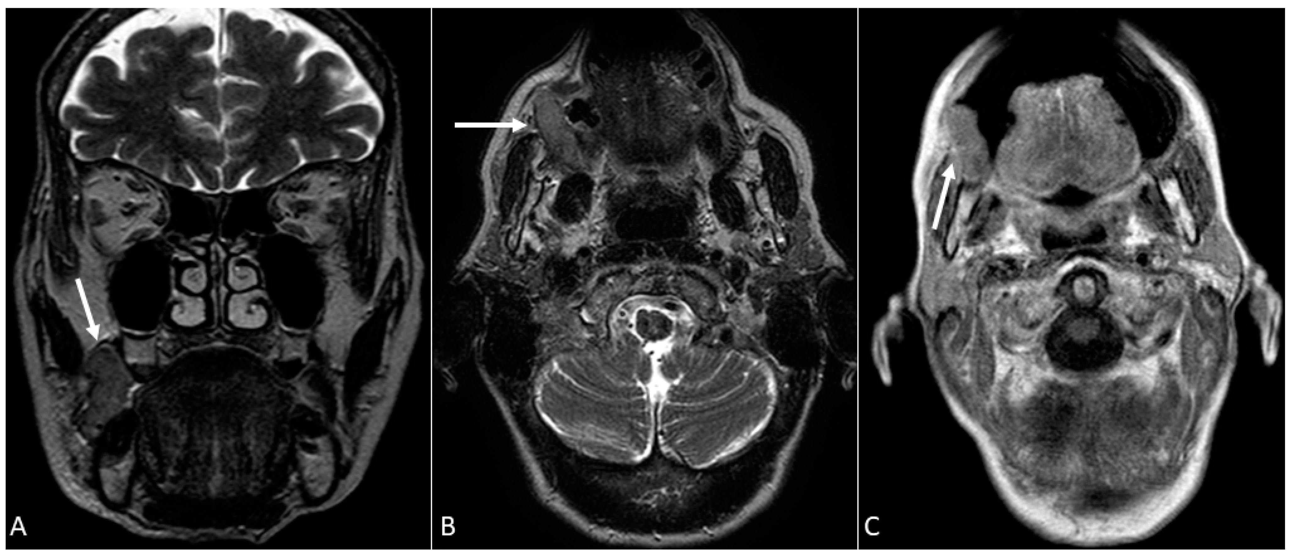 Applsci 12 01473 g011