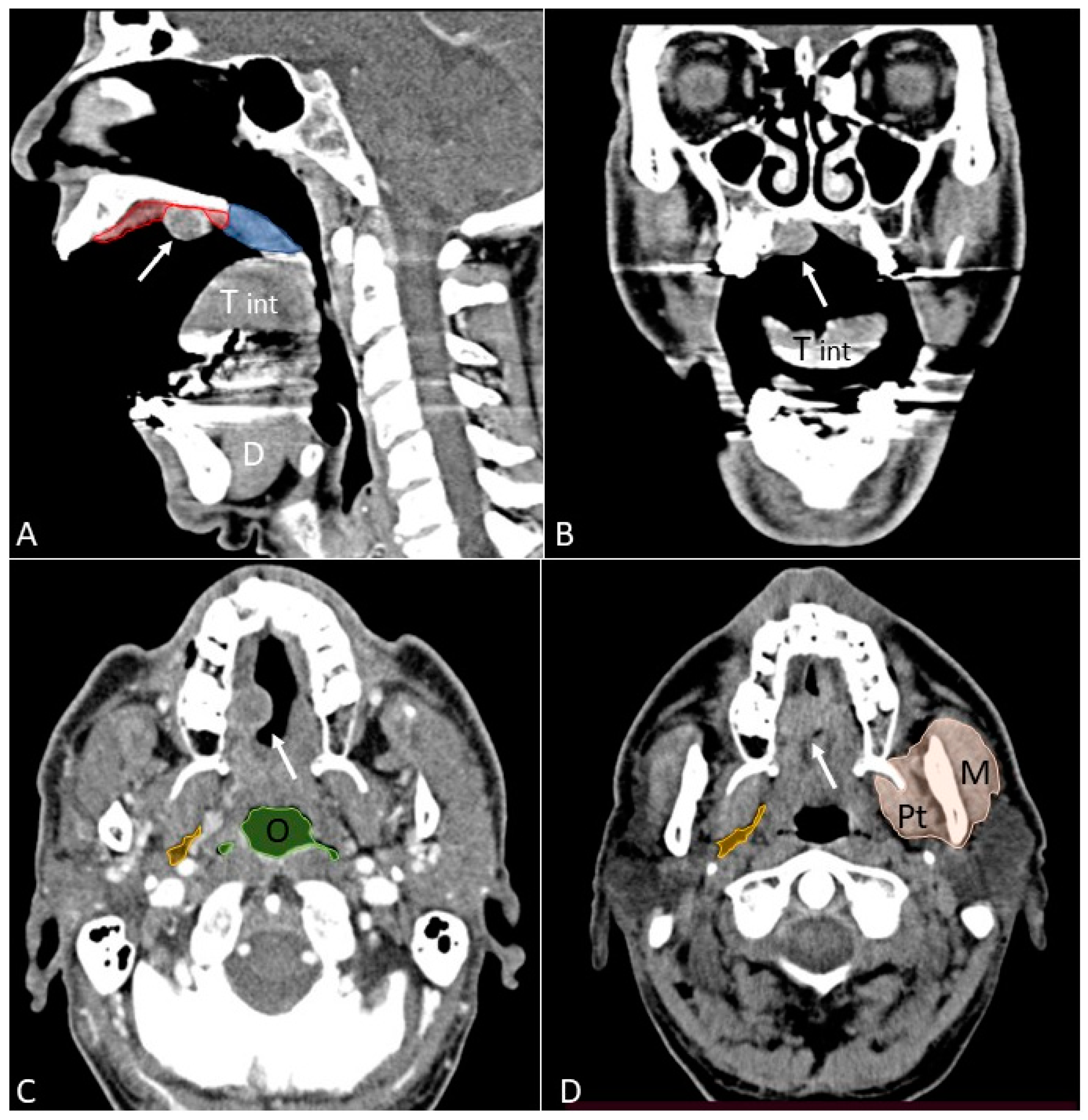 Applsci 12 01473 g012