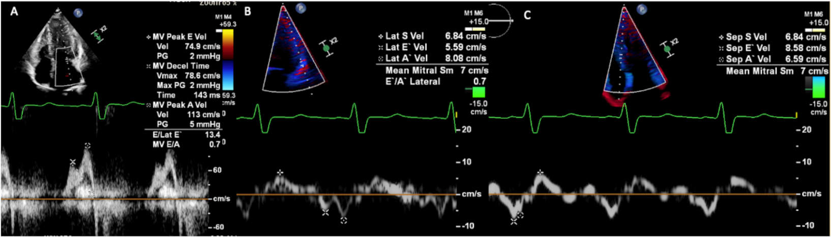Applsci 12 01605 g004