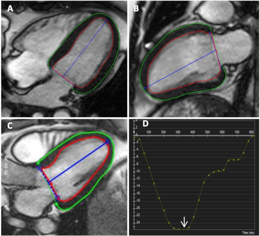 Applsci 12 01605 g006