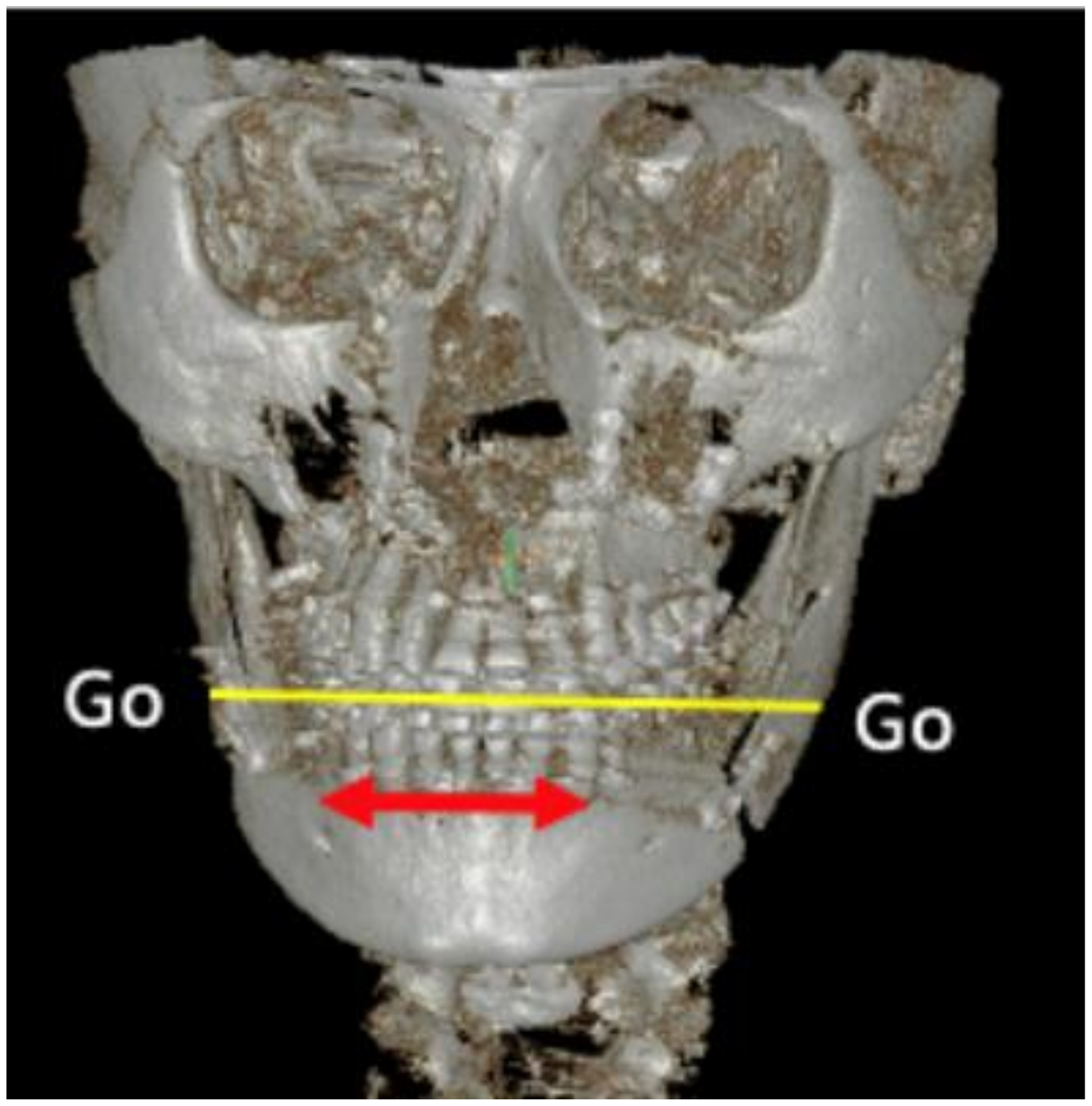 Applsci 12 01892 g002