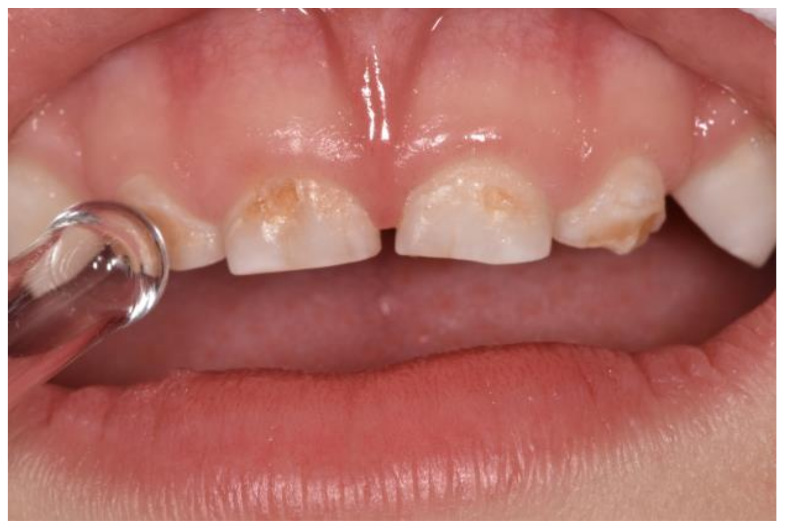 Applsci 12 01964 g001 Applsci 12 01964 g001