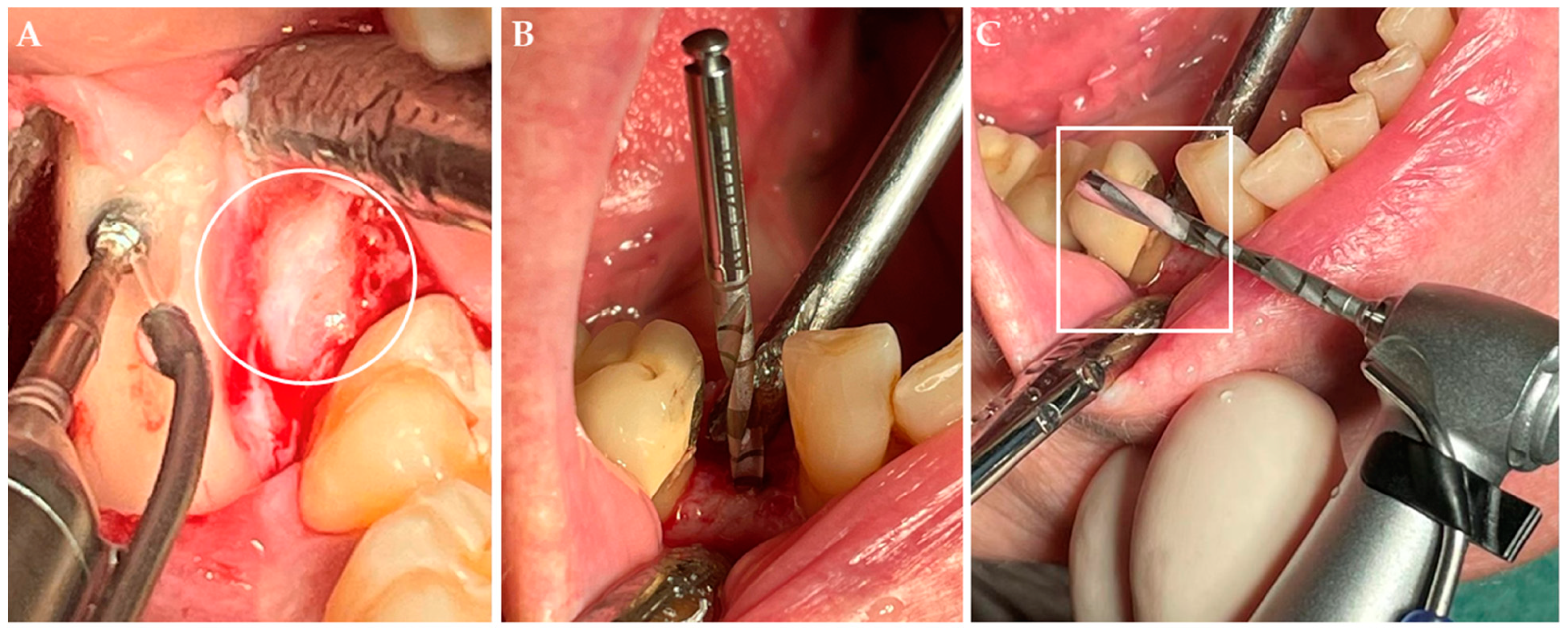 Applsci 12 02031 g002 Applsci 12 02031 g002