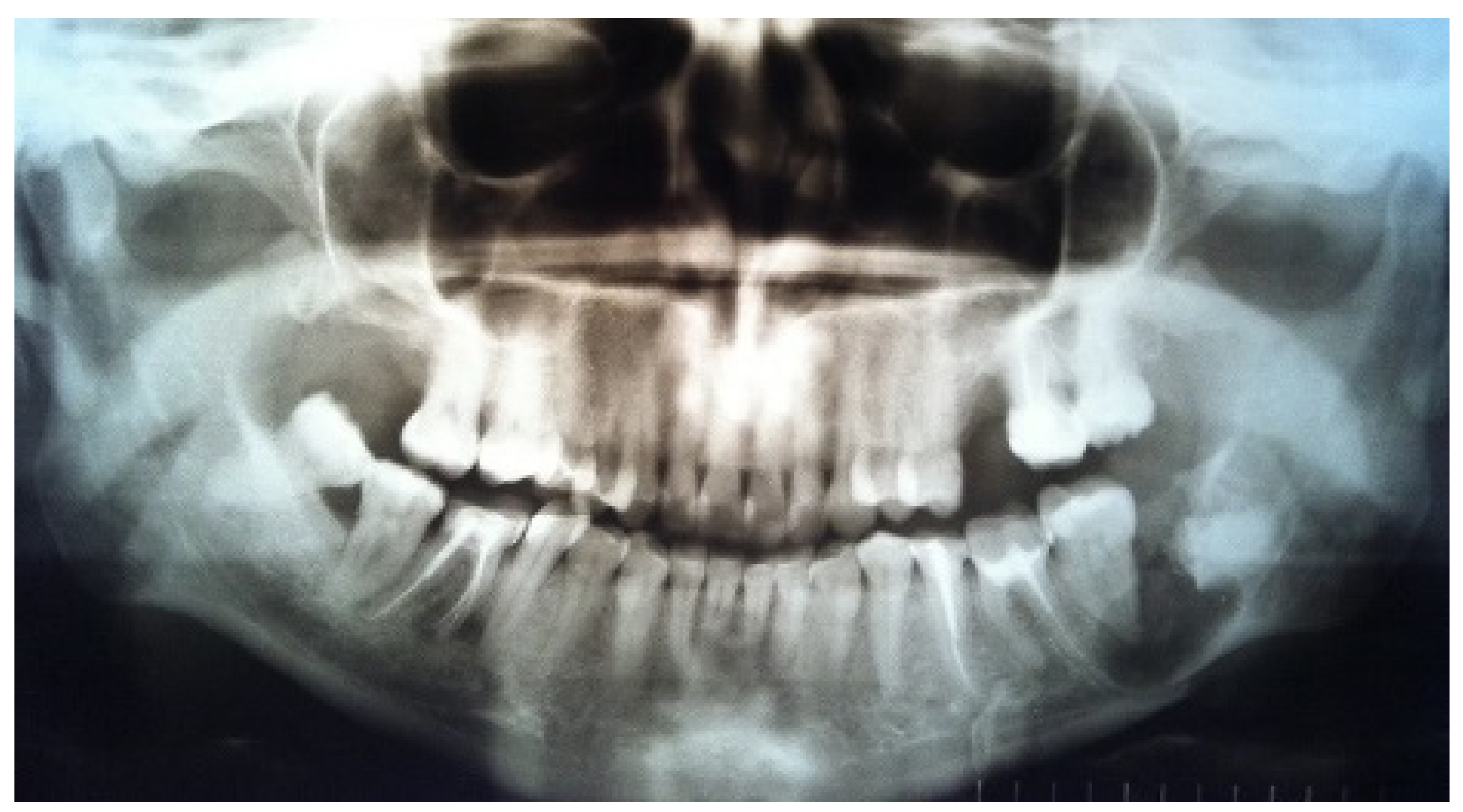 Applsci 12 02384 g001