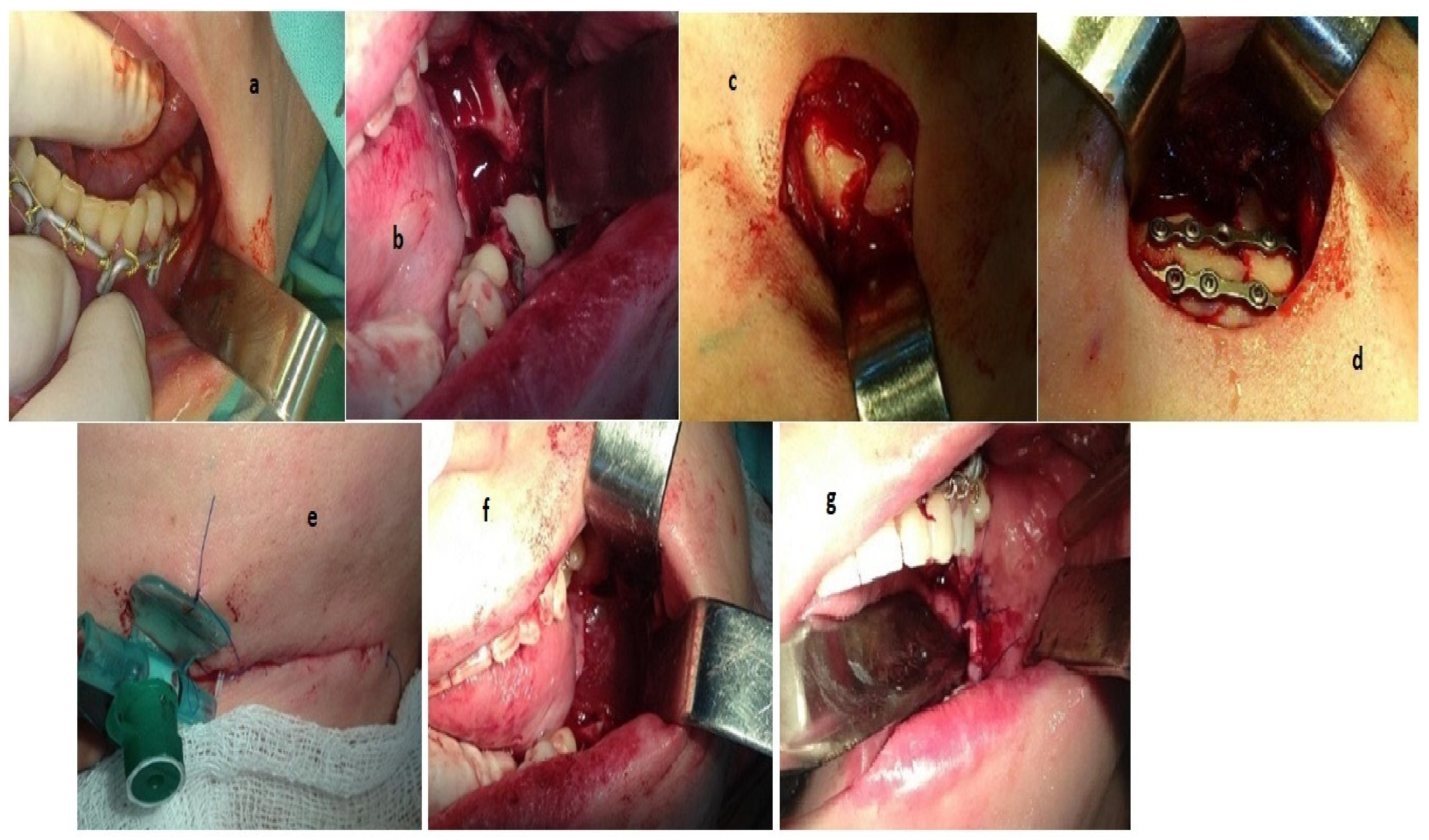 Applsci 12 02384 g003