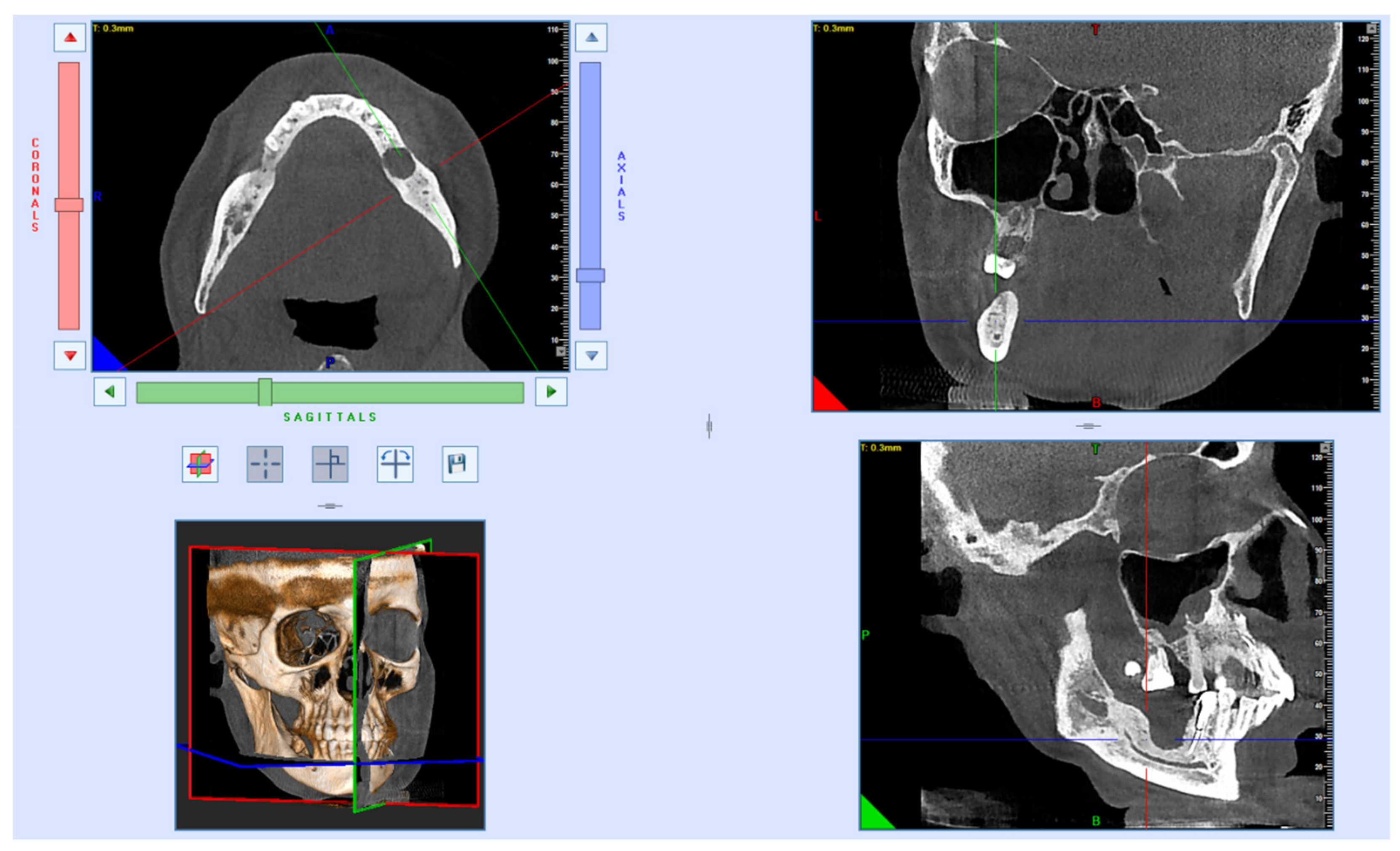 Applsci 12 02384 g005