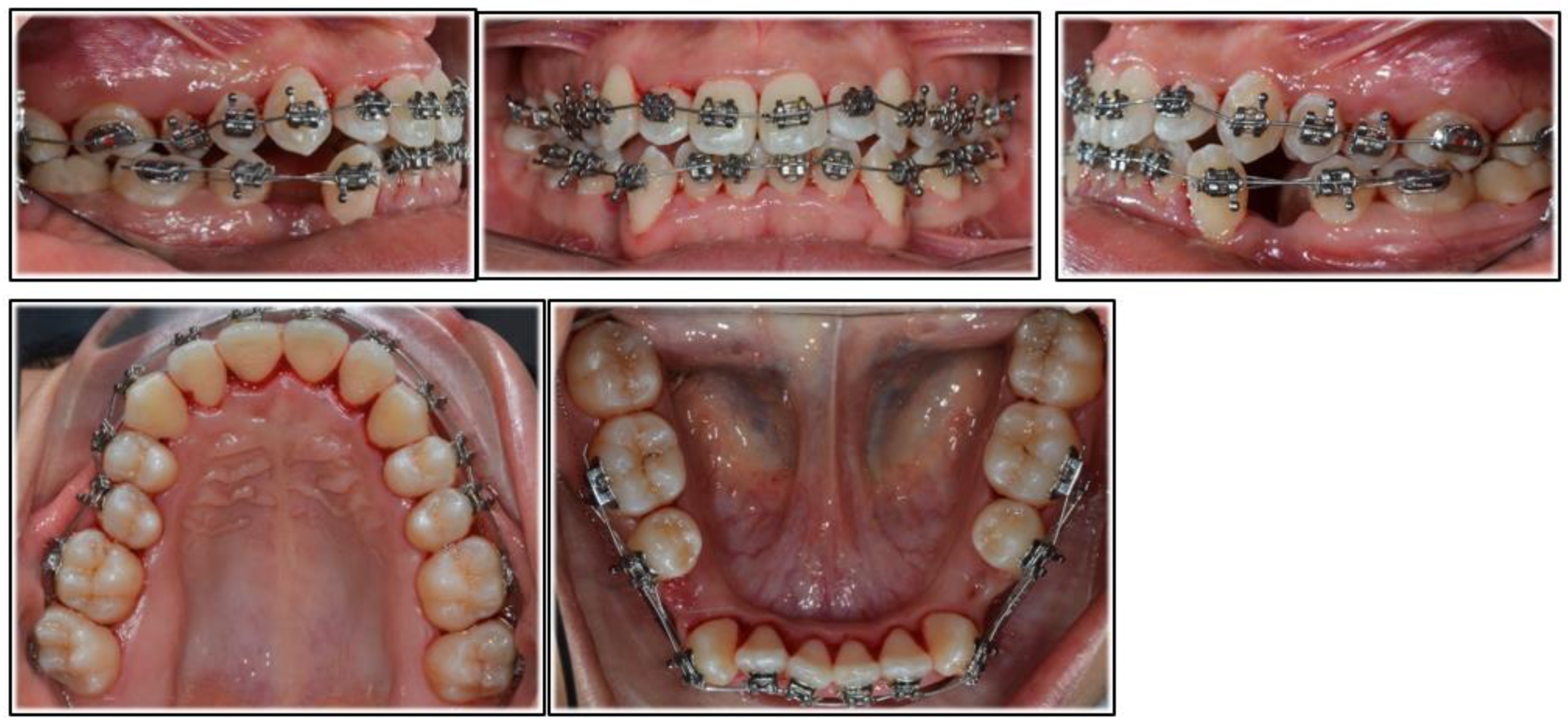 Applsci 12 02464 g002