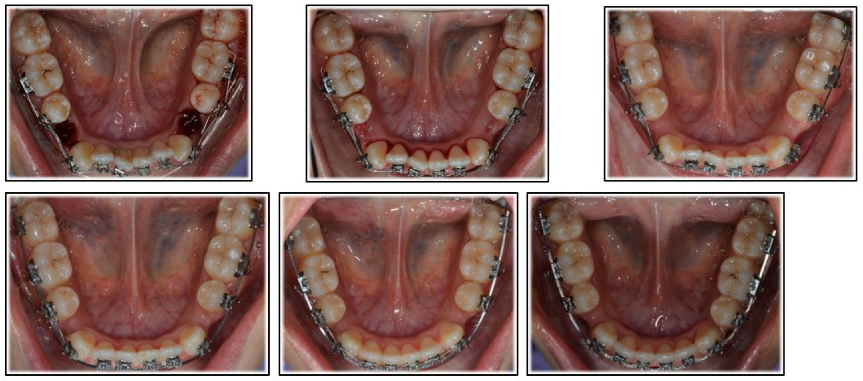 Applsci 12 02464 g003