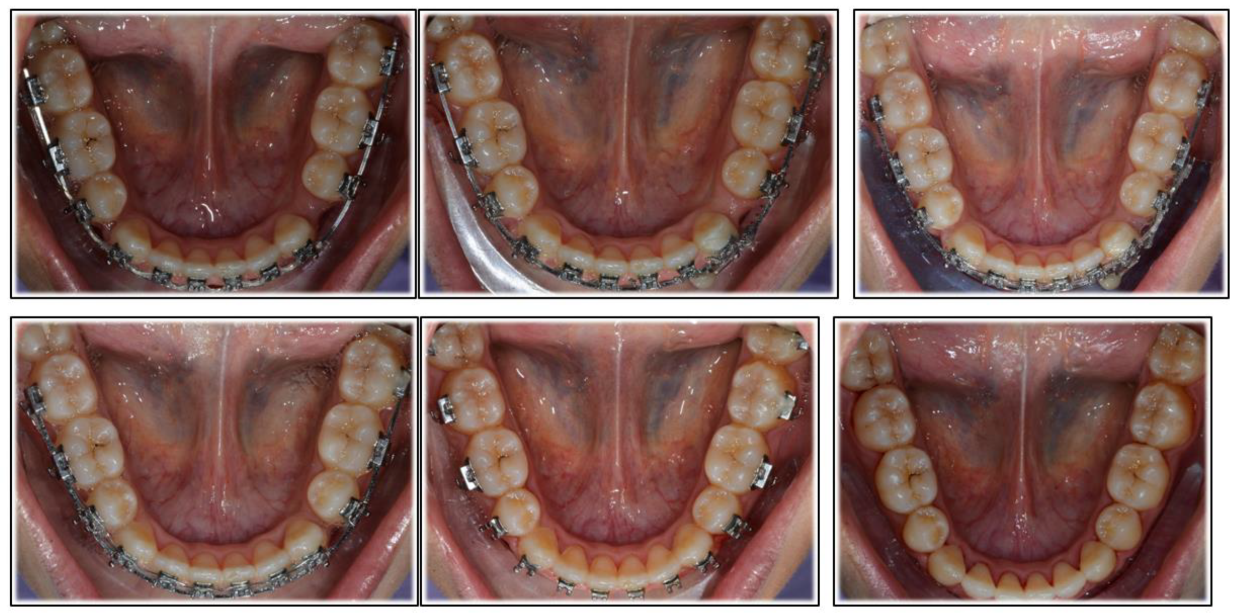 Applsci 12 02464 g004