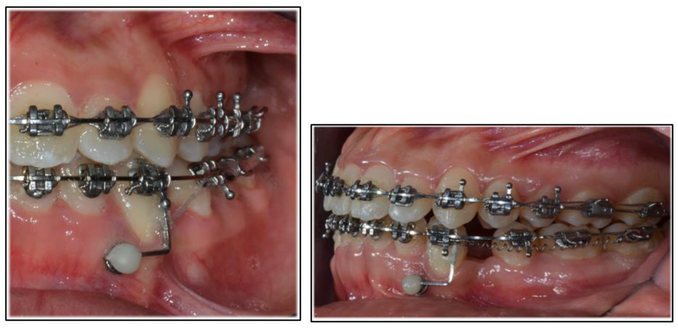 Applsci 12 02464 g005