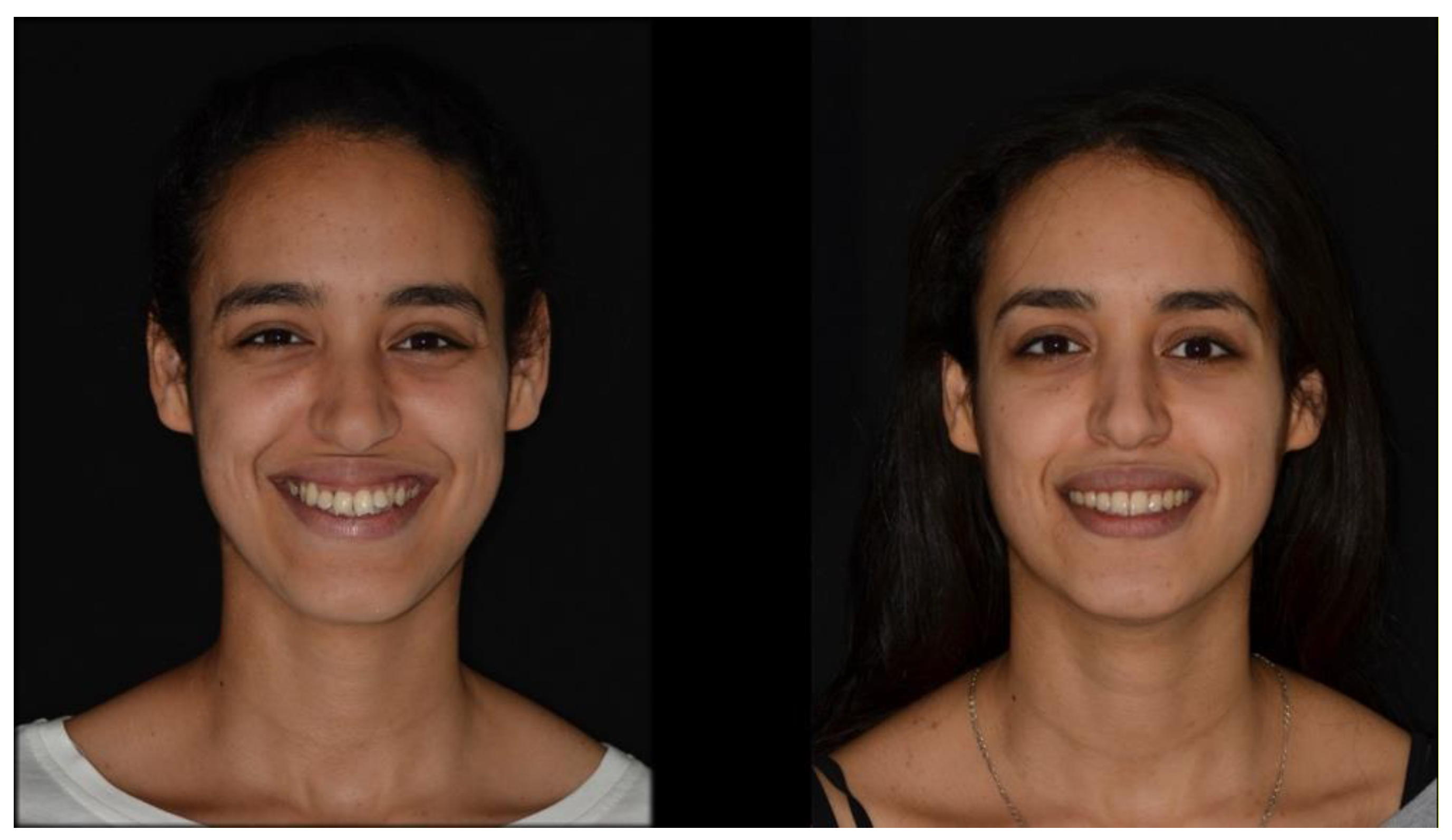 Applsci 12 02464 g006