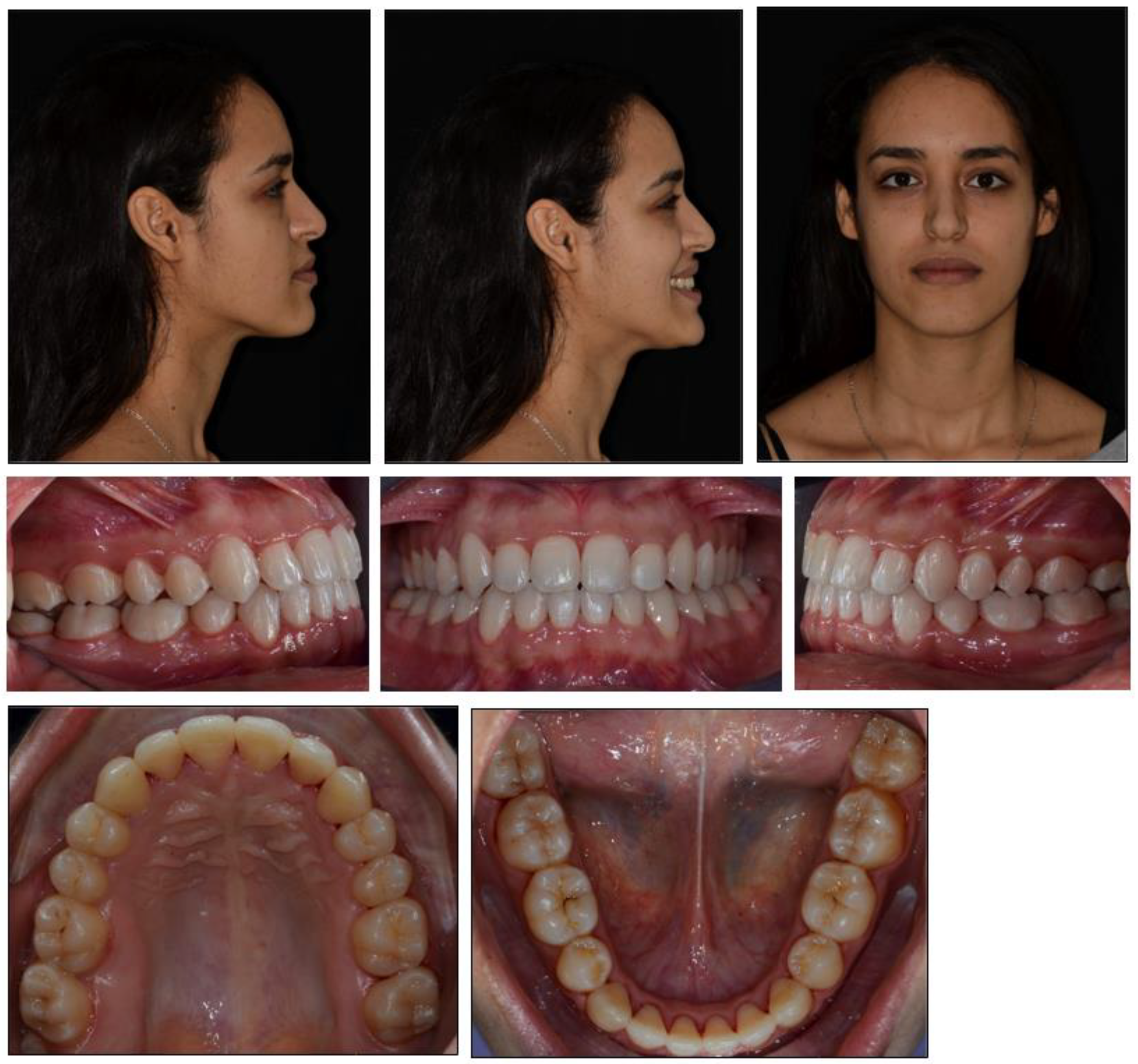 Applsci 12 02464 g007