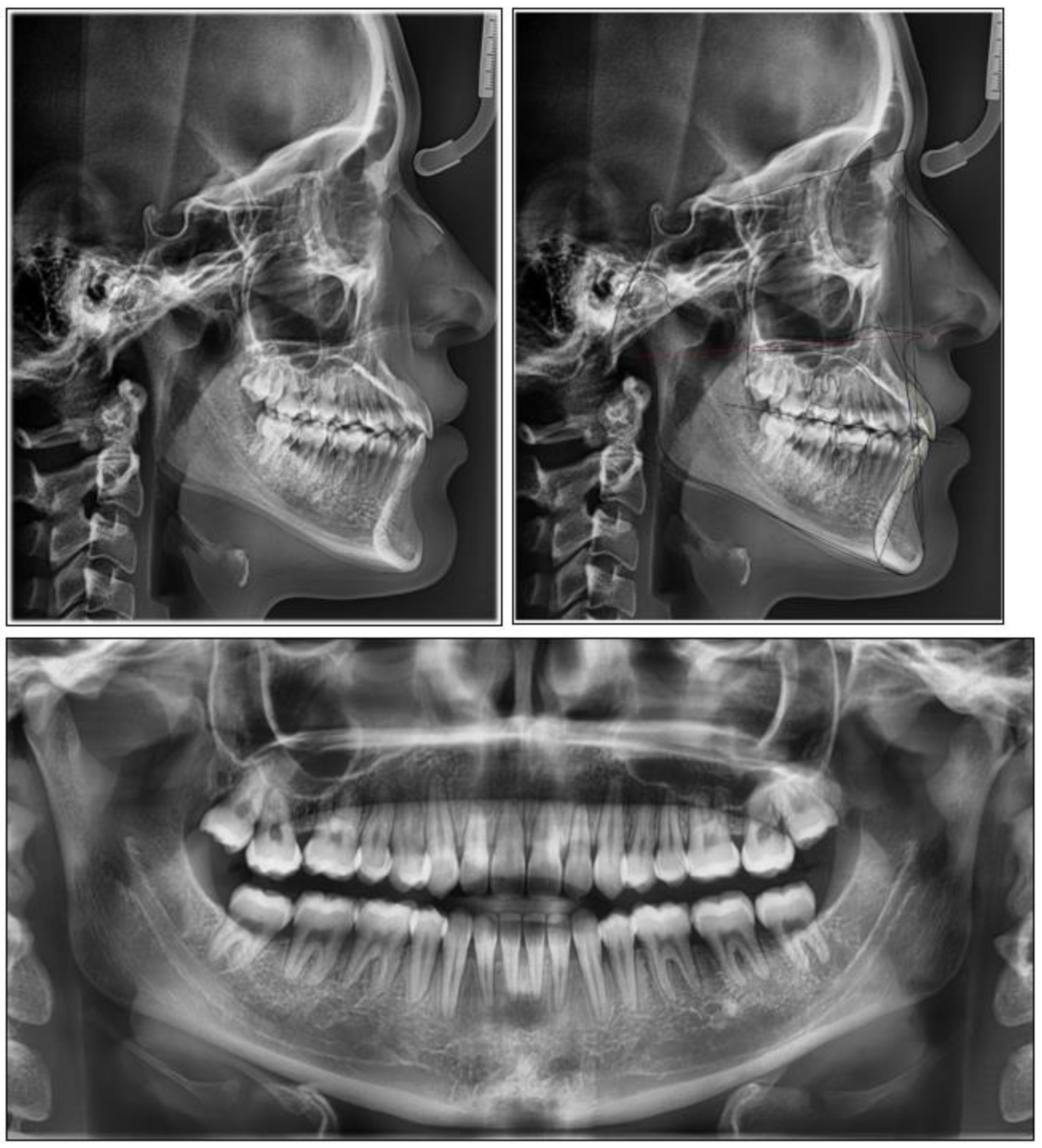 Applsci 12 02464 g008