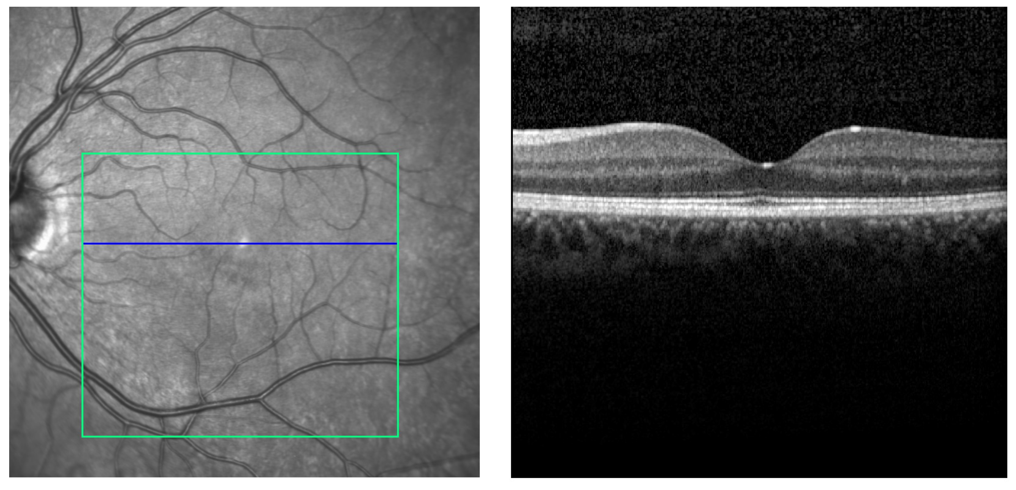 Applsci 12 02623 g004