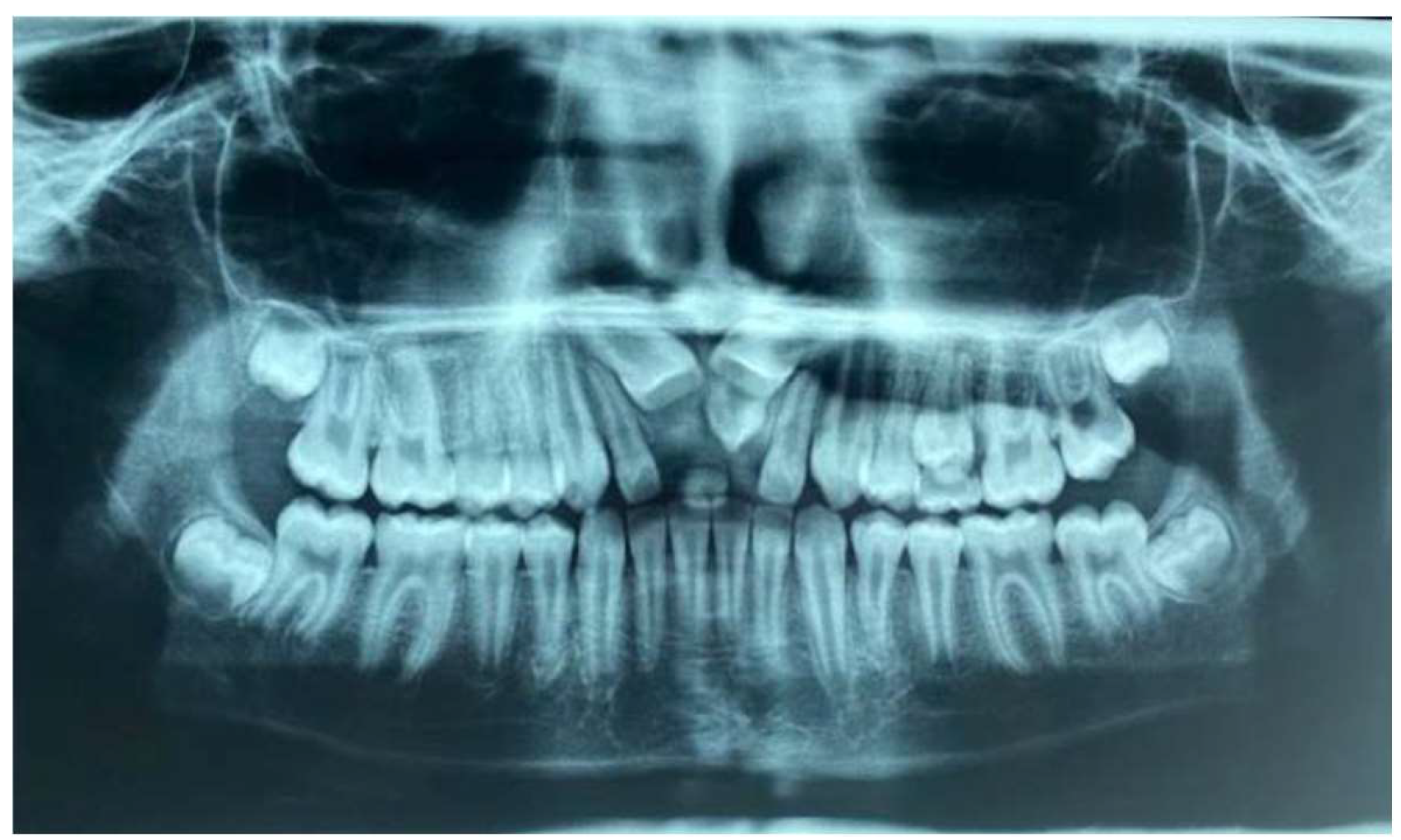 Applsci 12 02657 g002 Applsci 12 02657 g002