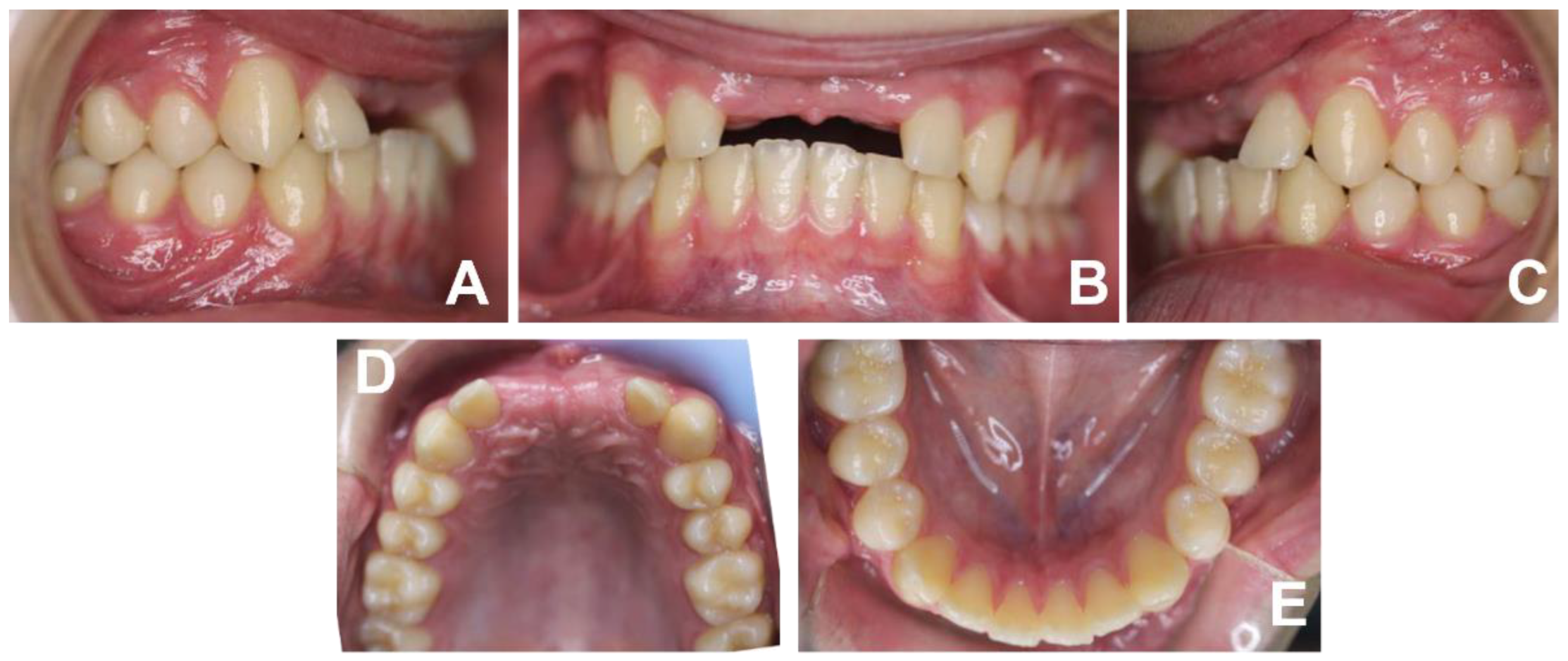 Applsci 12 02657 g004 Applsci 12 02657 g004