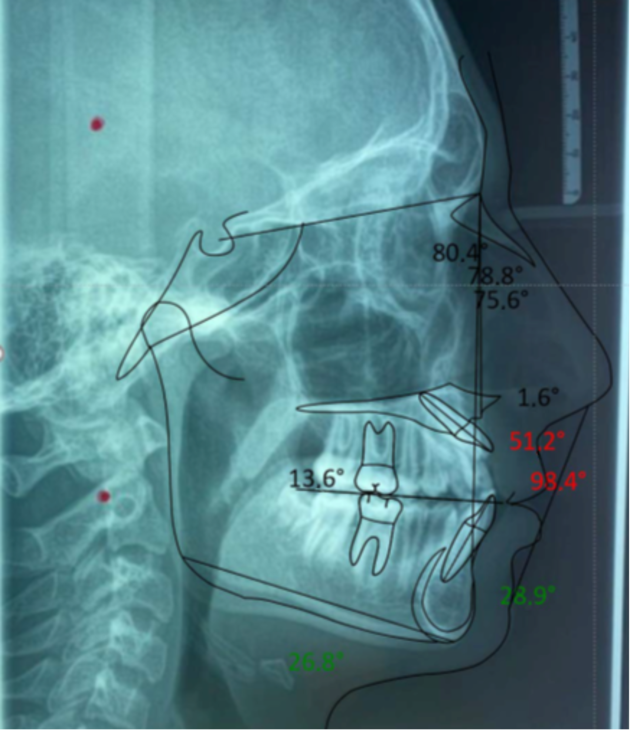 Applsci 12 02657 g006 Applsci 12 02657 g006