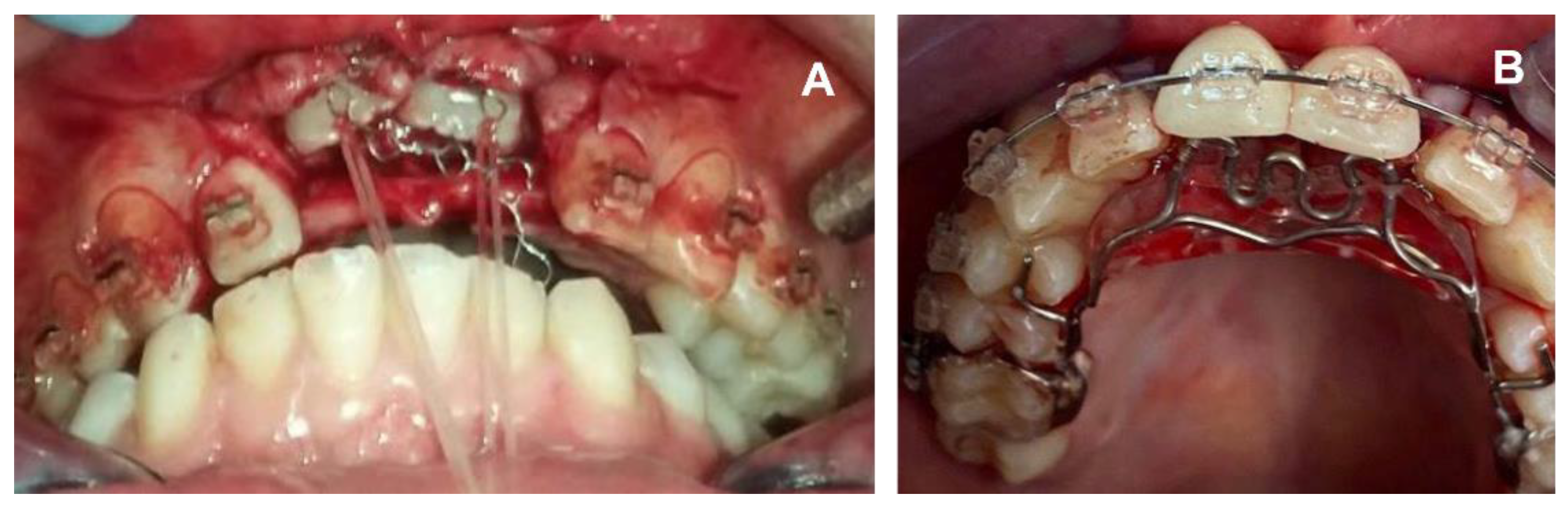 Applsci 12 02657 g008 Applsci 12 02657 g008