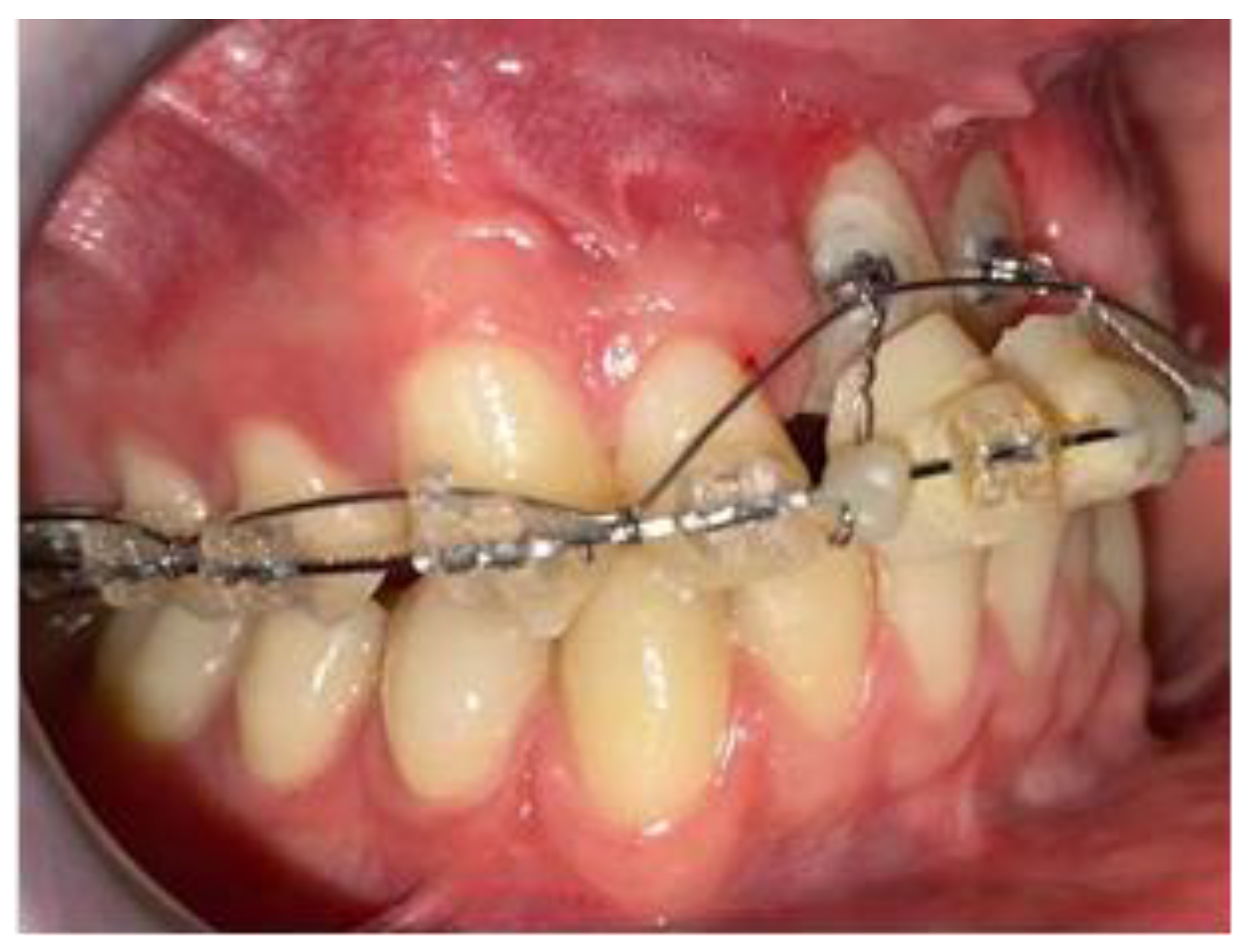 Applsci 12 02657 g009 Applsci 12 02657 g009