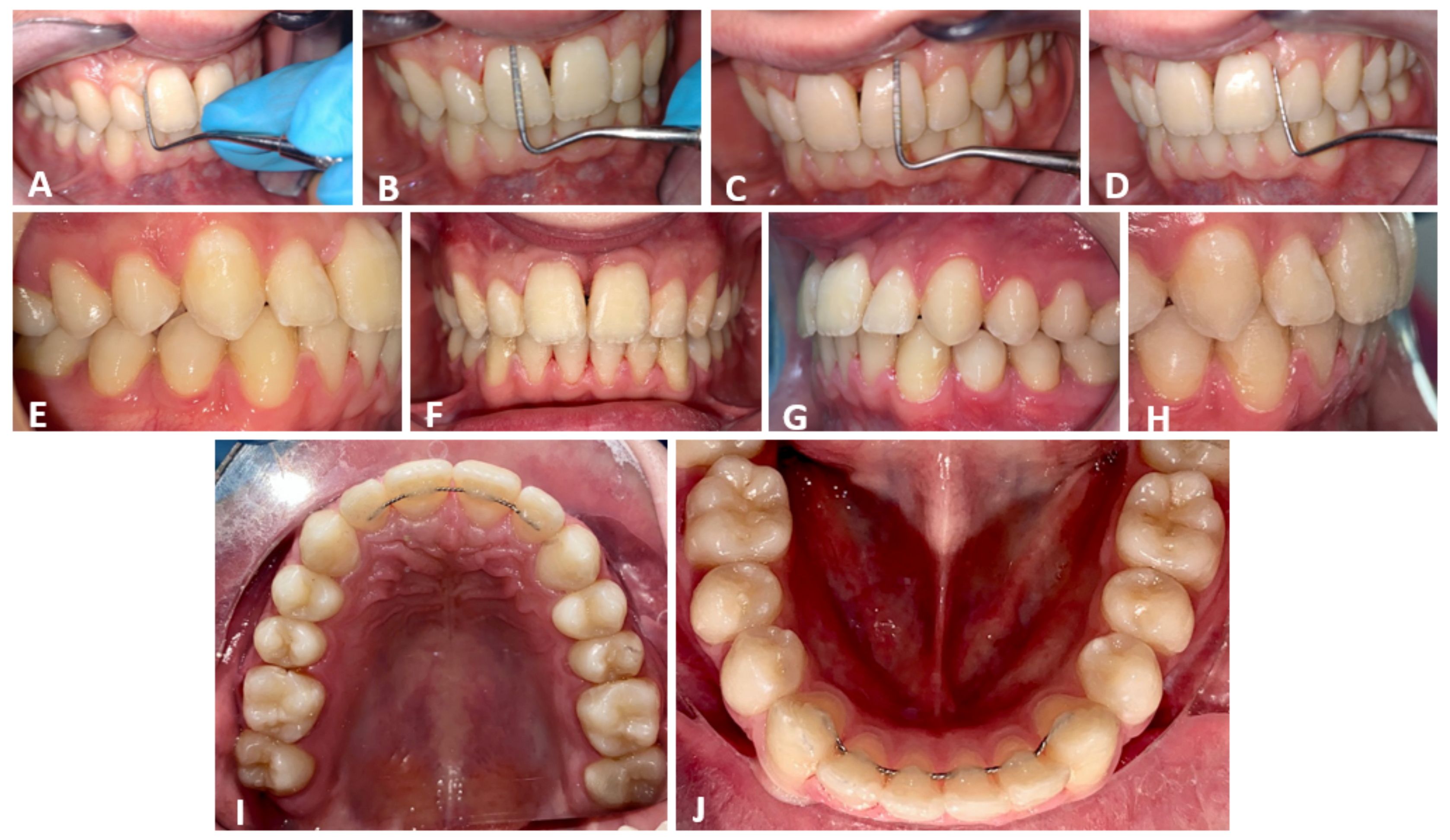 Applsci 12 02657 g012 Applsci 12 02657 g012