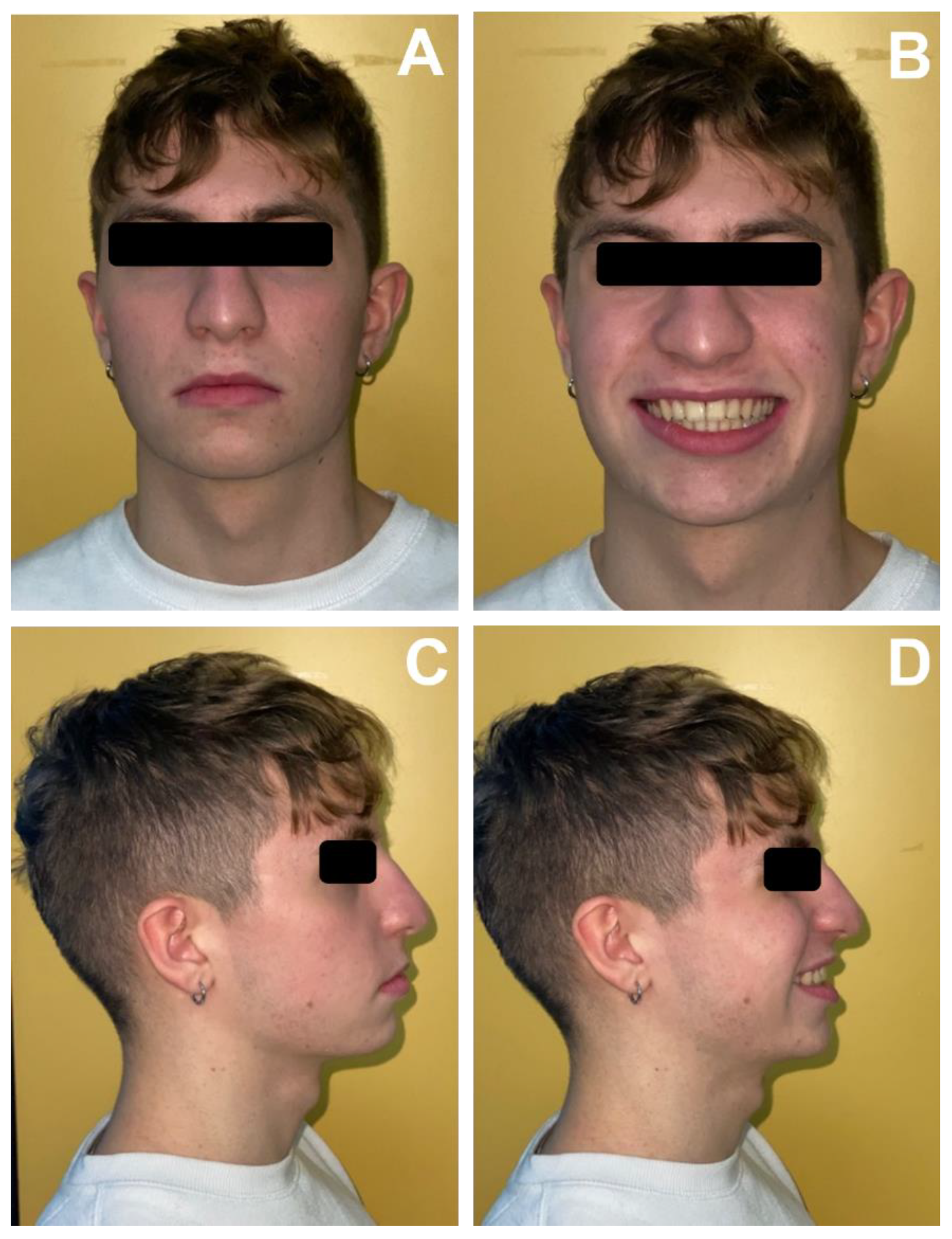 Applsci 12 02657 g013 Applsci 12 02657 g013