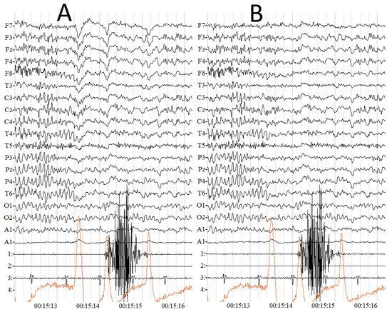 Discriminative Frequencies and Temporal EEG Segmentation in the