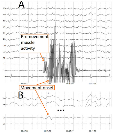 Discriminative Frequencies and Temporal EEG Segmentation in the