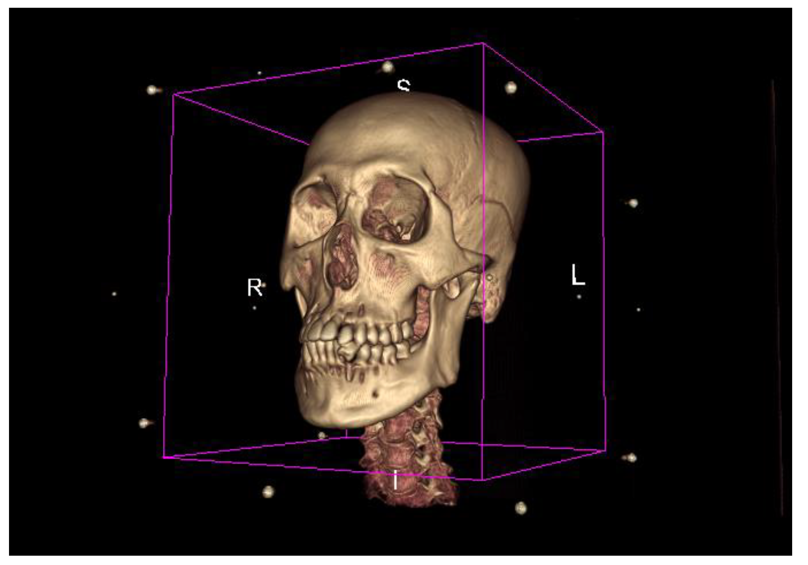 Applied Sciences | Free Full-Text | 2D/3D Multimode Medical Image Registration Based on Normalized Cross-Correlation | HTML