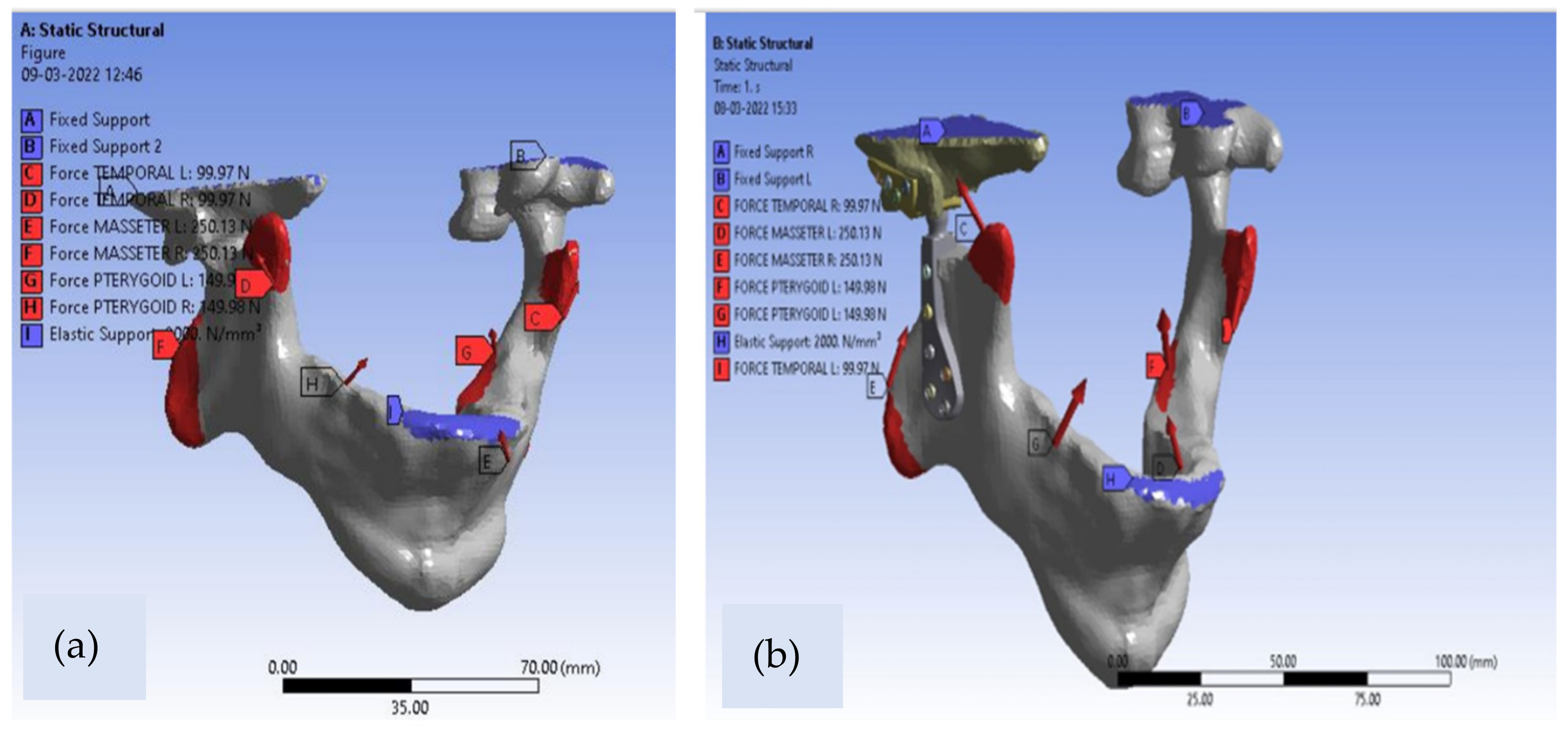 Applsci 12 03003 g004 550