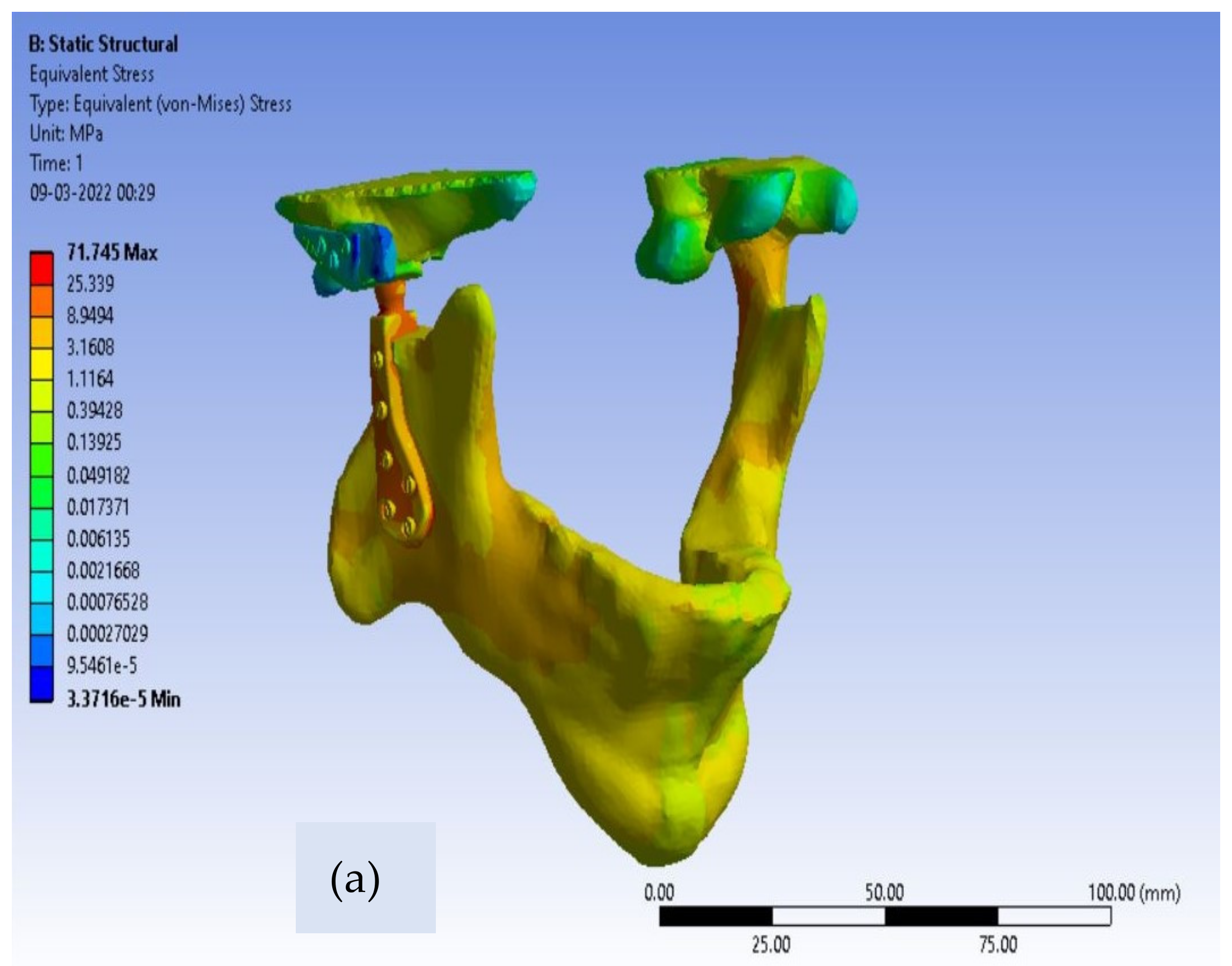 Applsci 12 03003 g007a 550