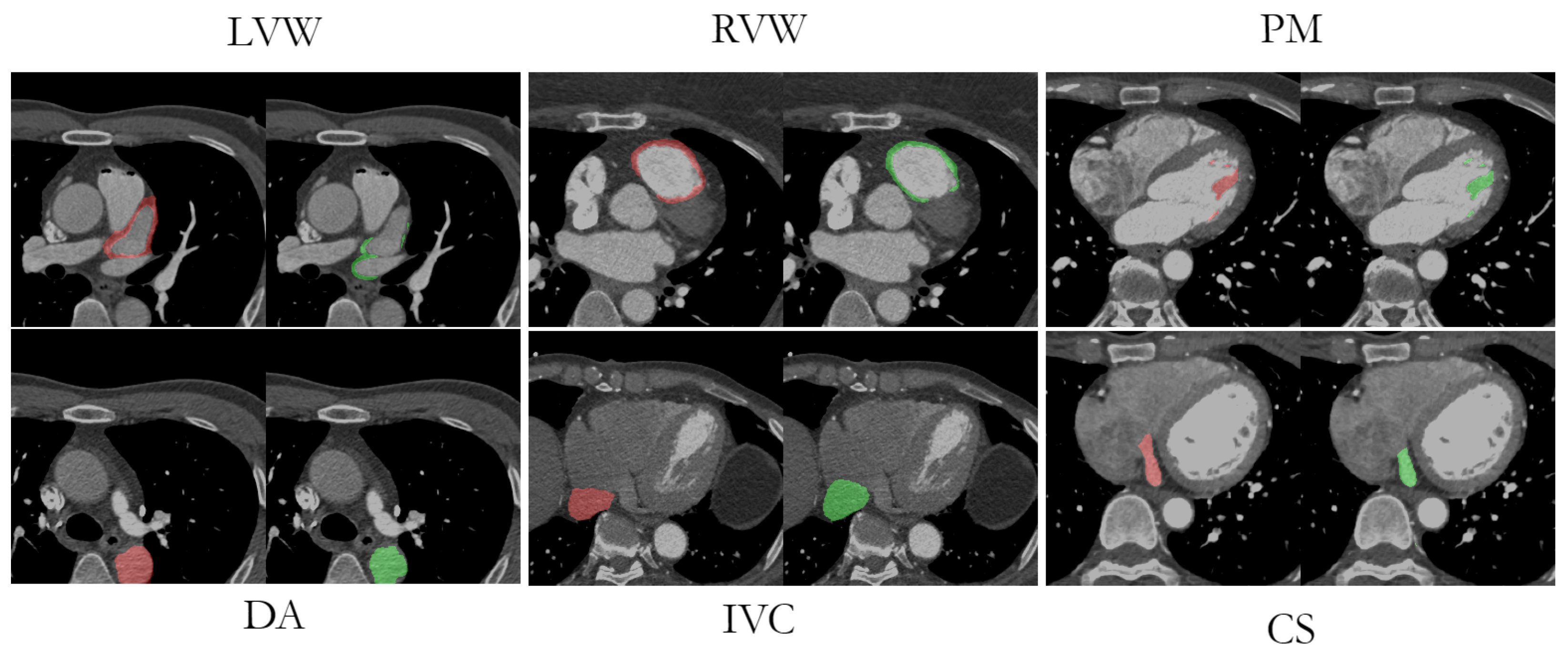 Applsci 12 03024 g008 550