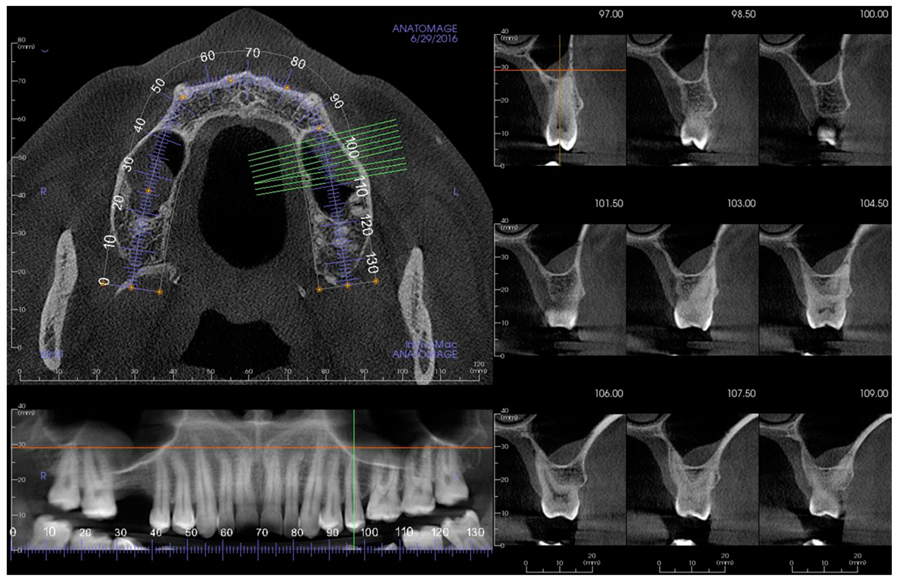 Applsci 12 03057 g001