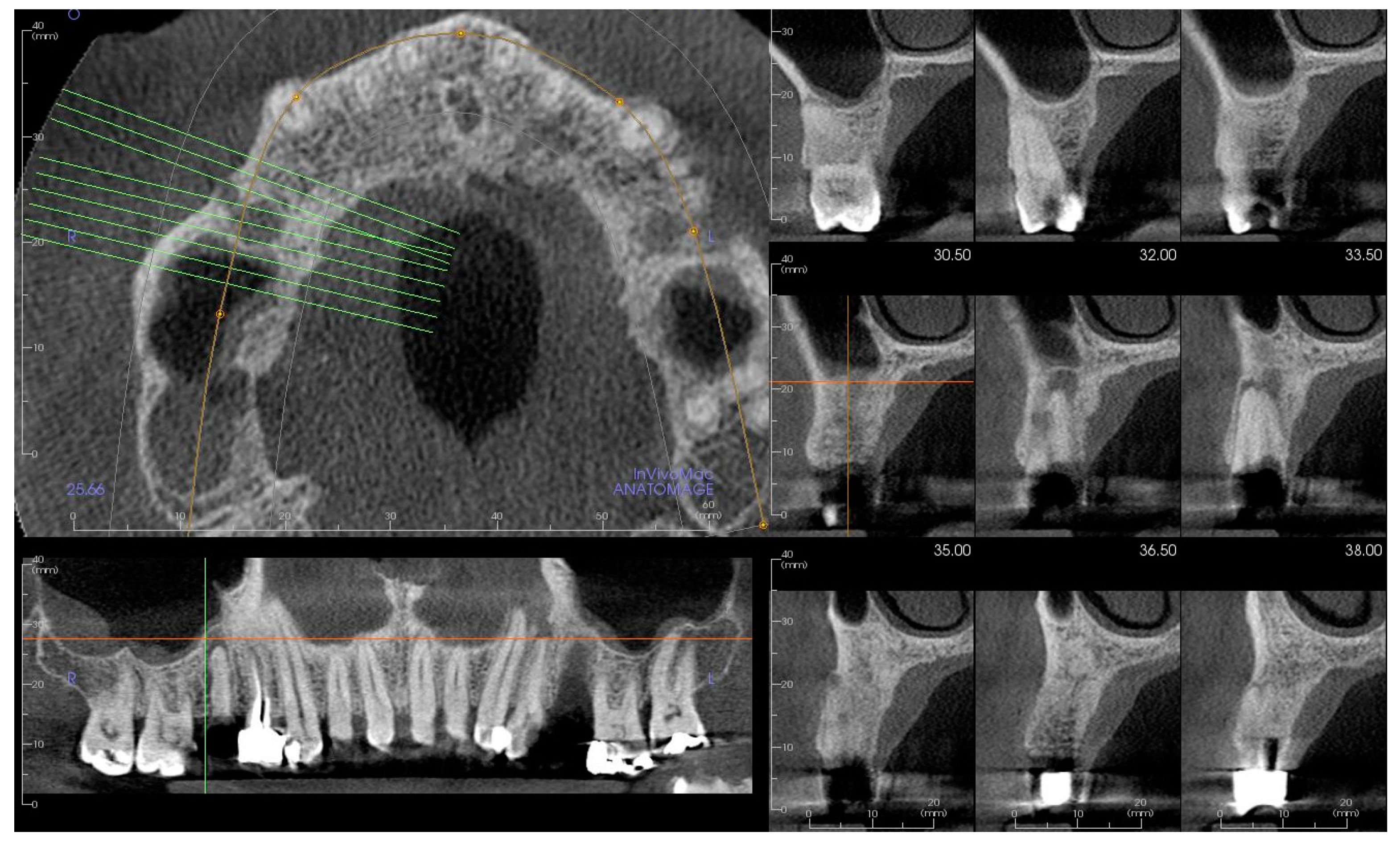 Applsci 12 03057 g004