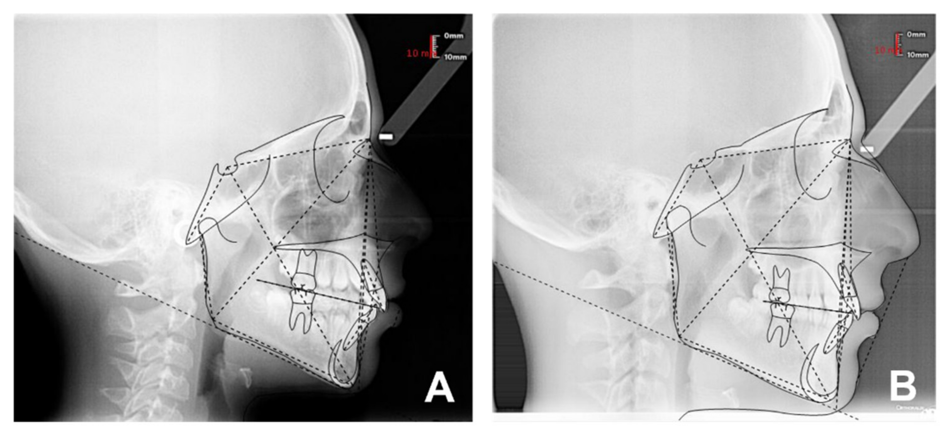 Applsci 12 03259 g002 Applsci 12 03259 g002