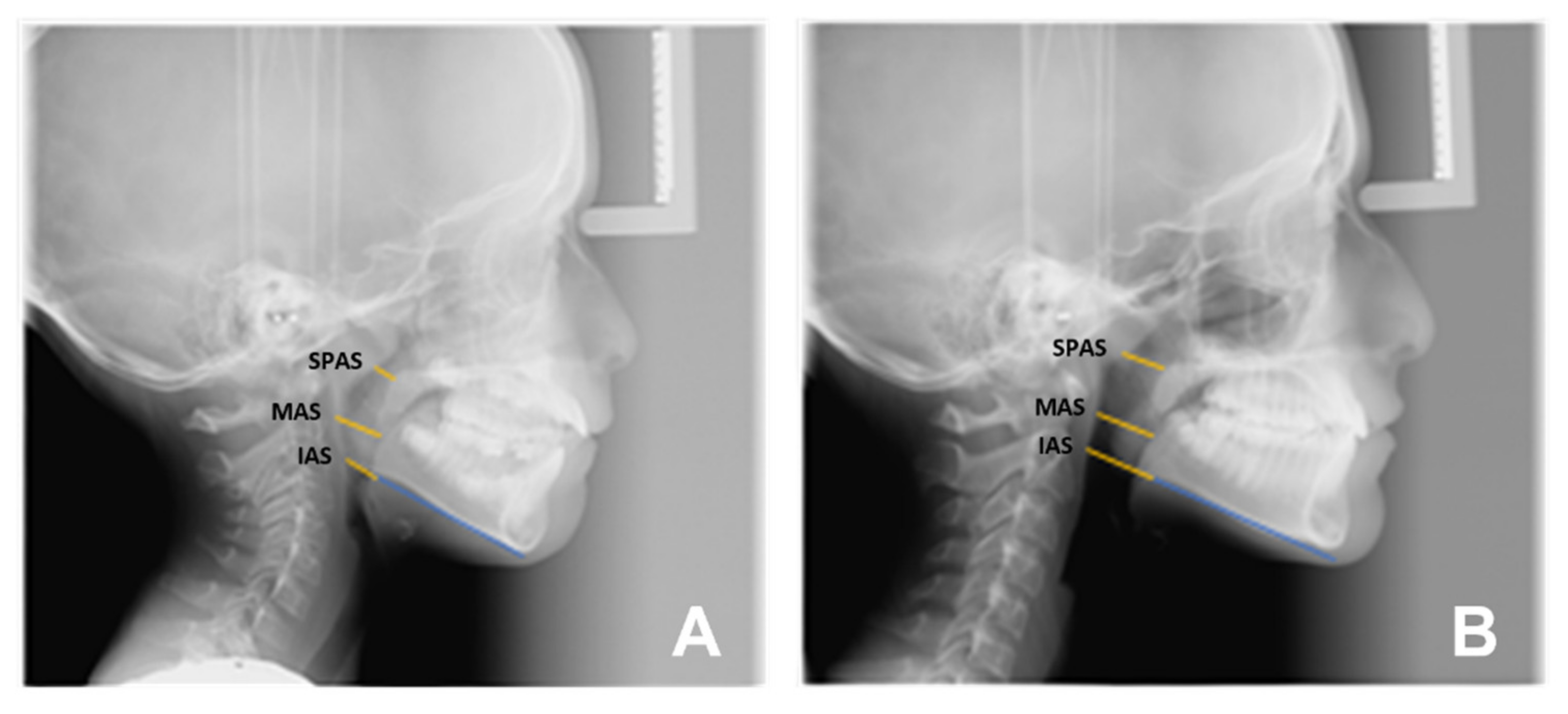 Applsci 12 03259 g003 Applsci 12 03259 g003