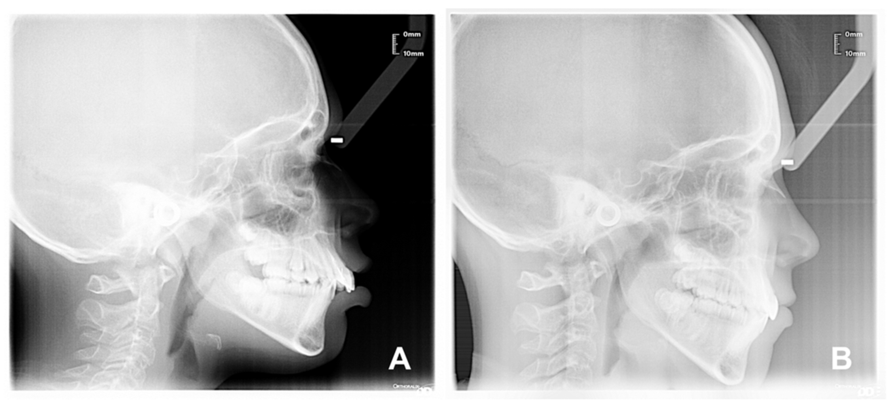 Applsci 12 03259 g005 Applsci 12 03259 g005