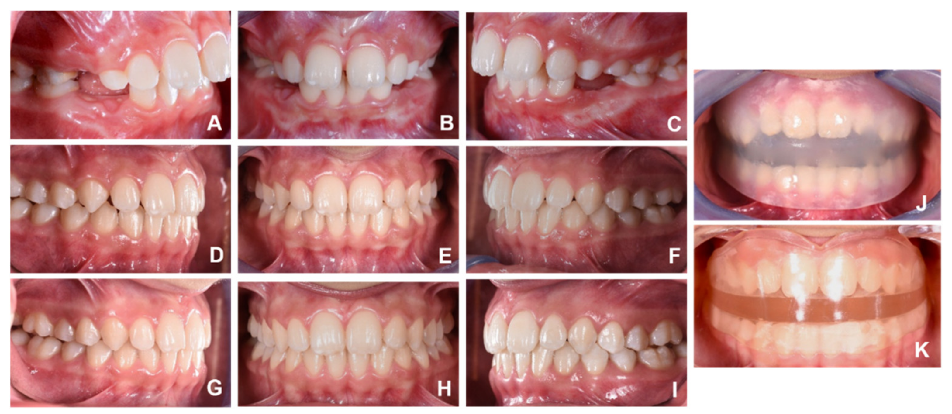 Applsci 12 03259 g006 Applsci 12 03259 g006