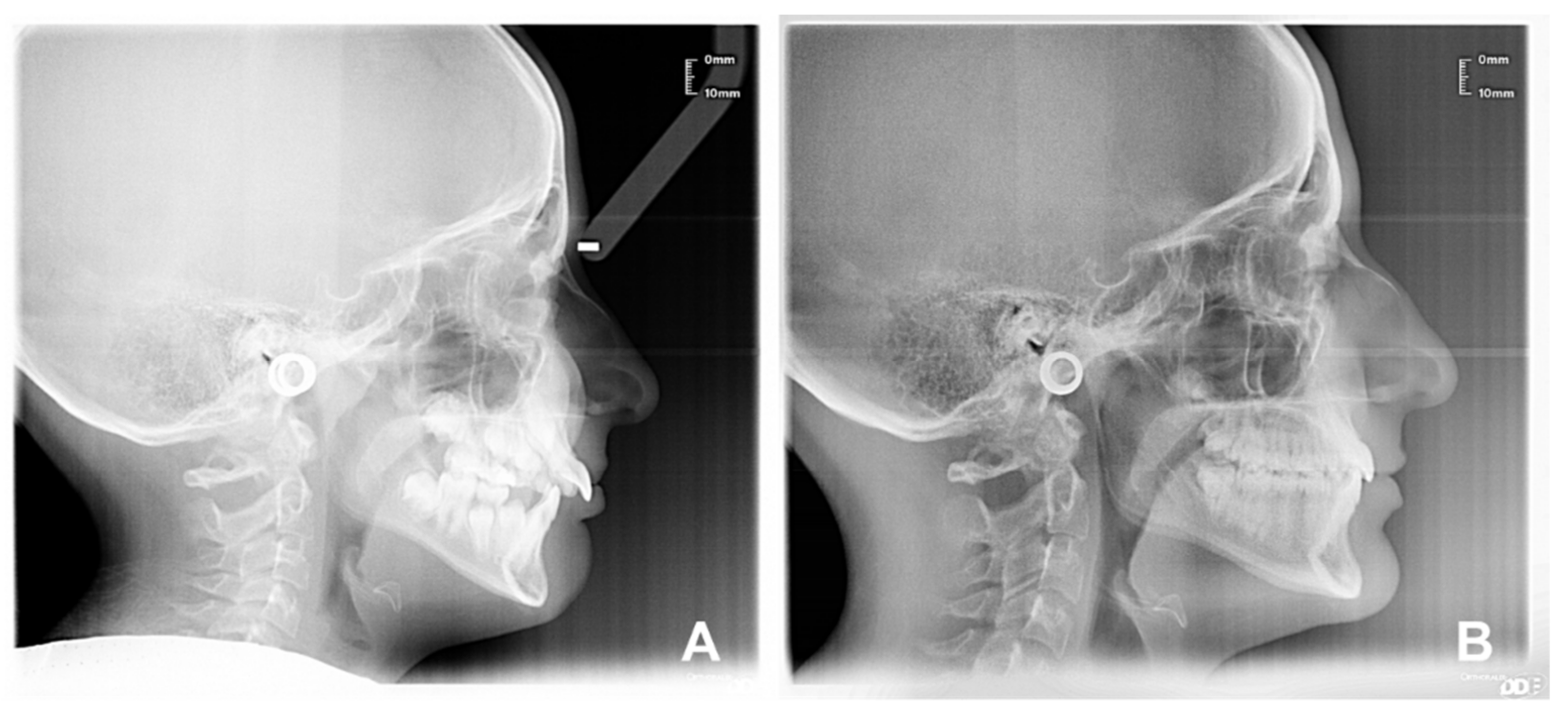 Applsci 12 03259 g007 Applsci 12 03259 g007