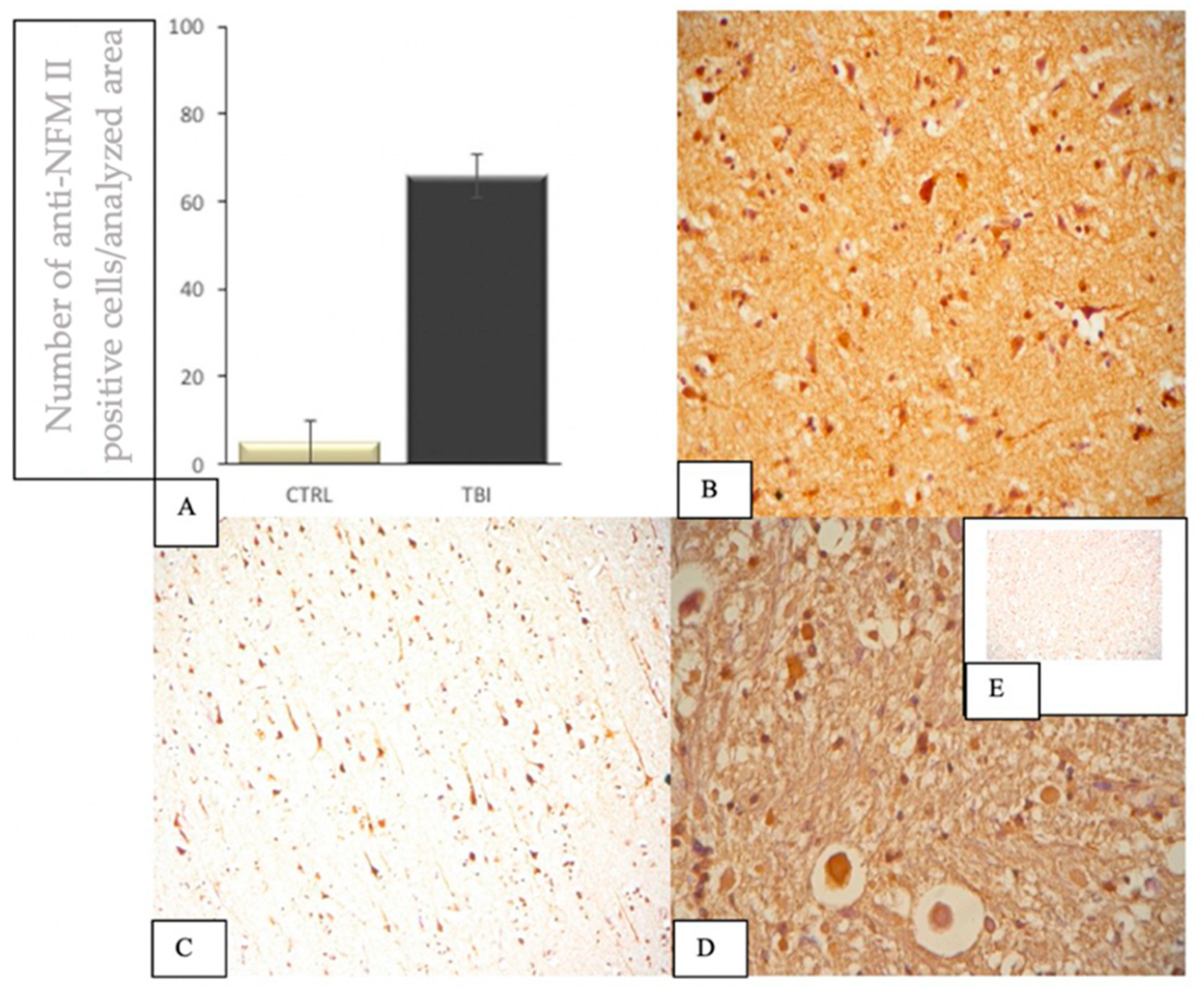 Applsci 12 03638 g011