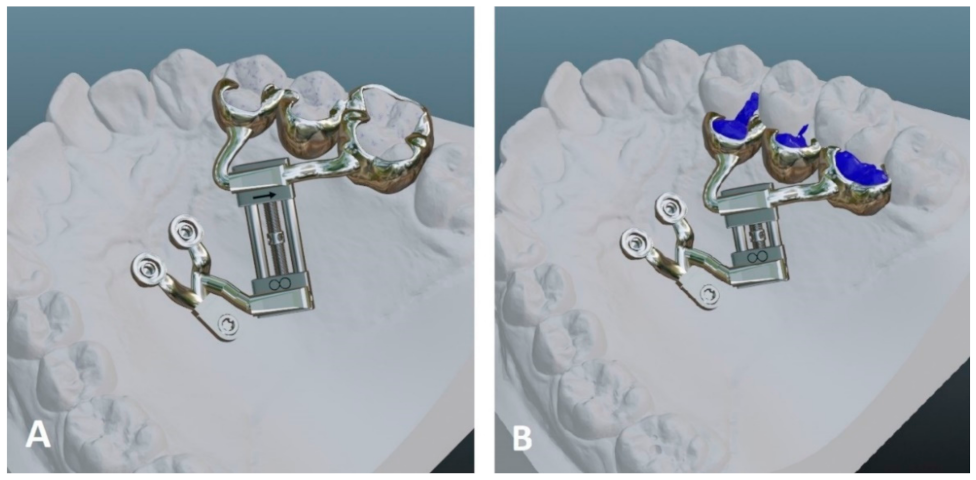 Applsci 12 03820 g003