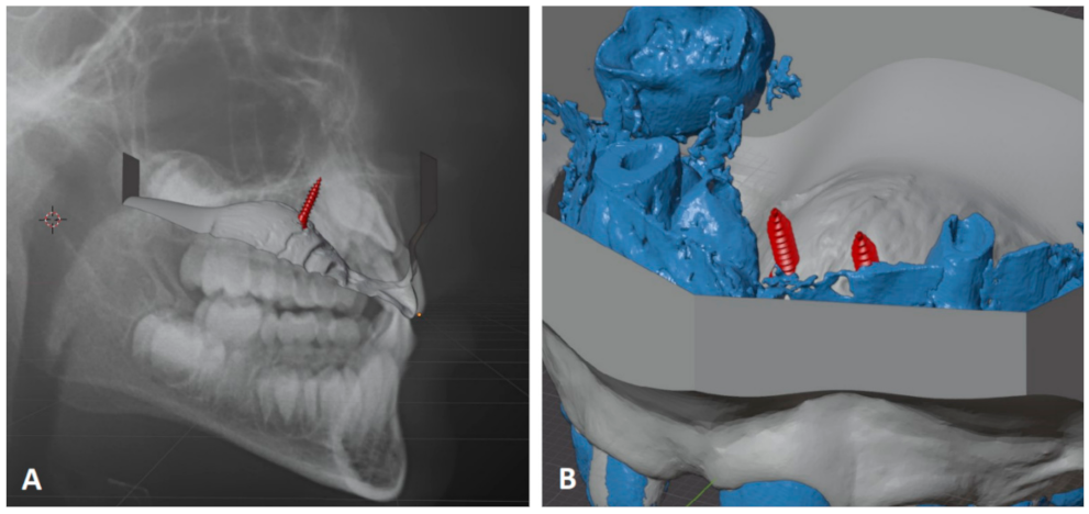 Applsci 12 03820 g004