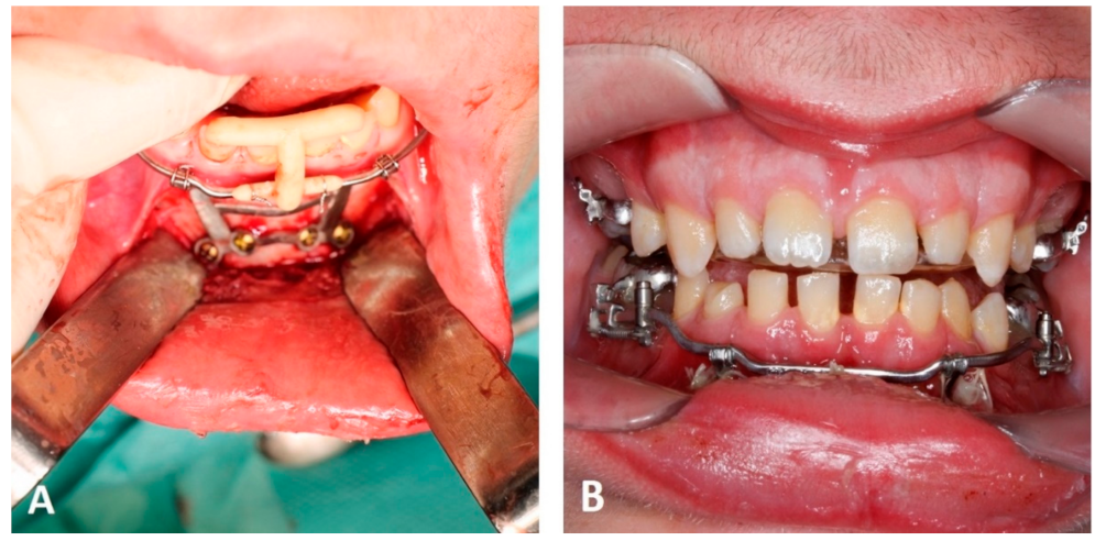Applsci 12 03820 g010