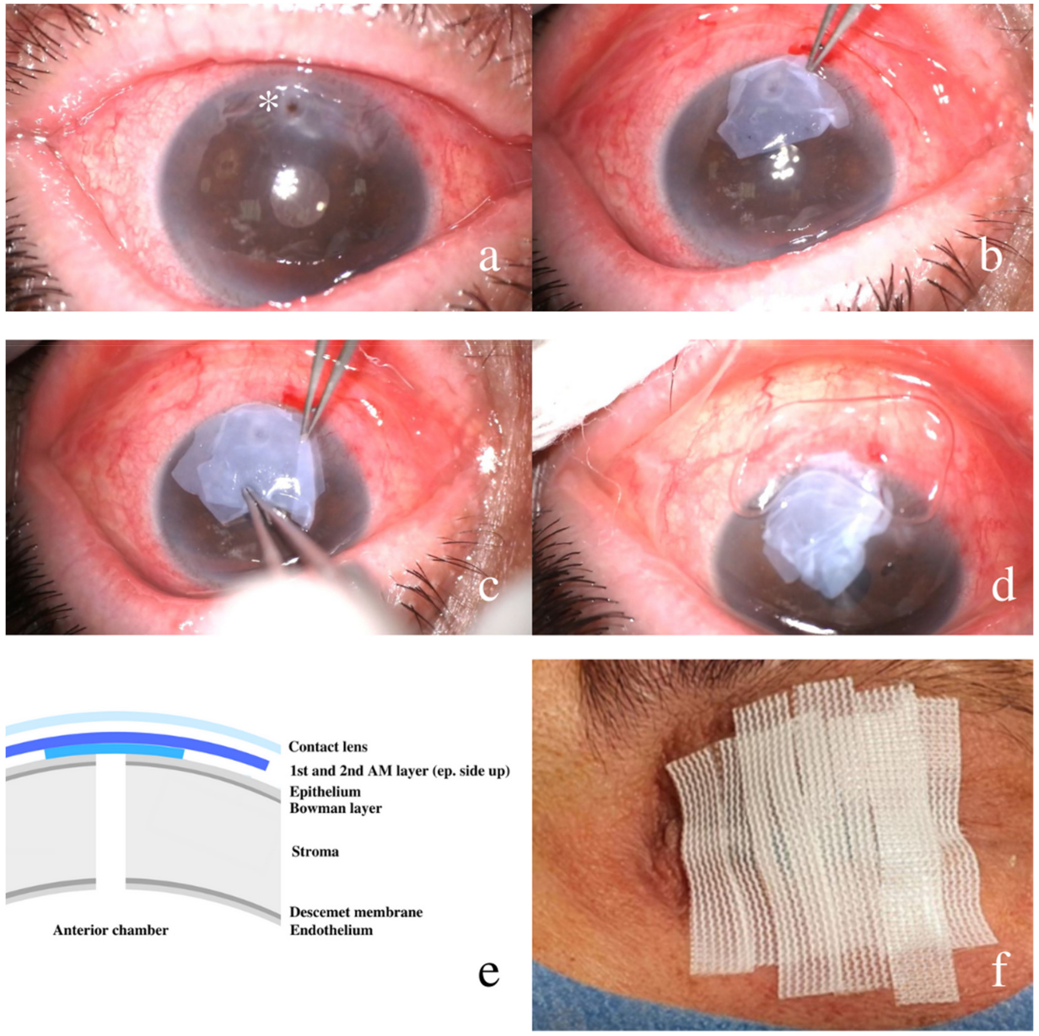 7 Potential Causes Of Red Spots In Your Eyes | OnlyMyHealth