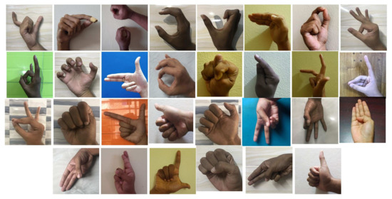 BenSignNet: Bengali Sign Language Alphabet Recognition Using ...